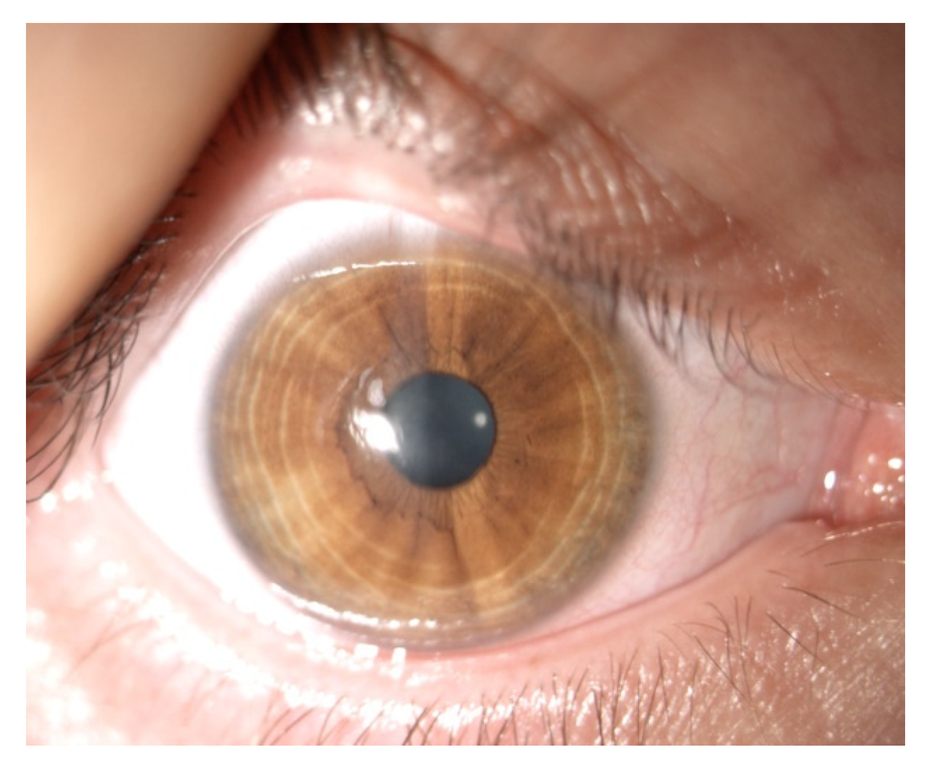 Jcm 11 00585 g008 Jcm 11 00585 g008