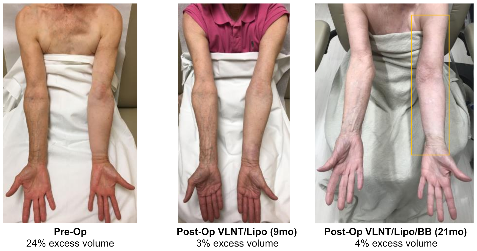 Jcm 11 00598 g003 Jcm 11 00598 g003