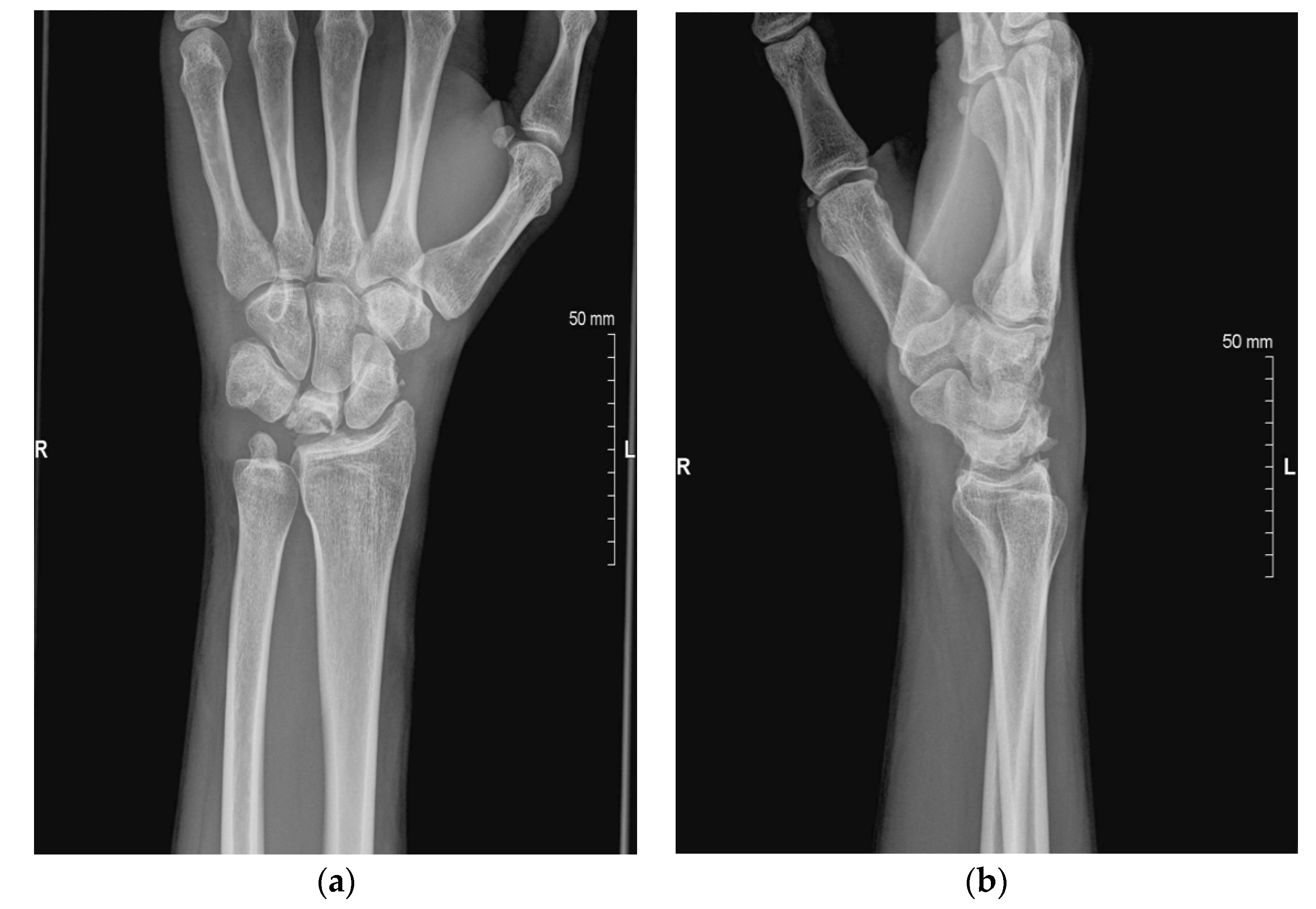 Jcm 11 00664 g002 550