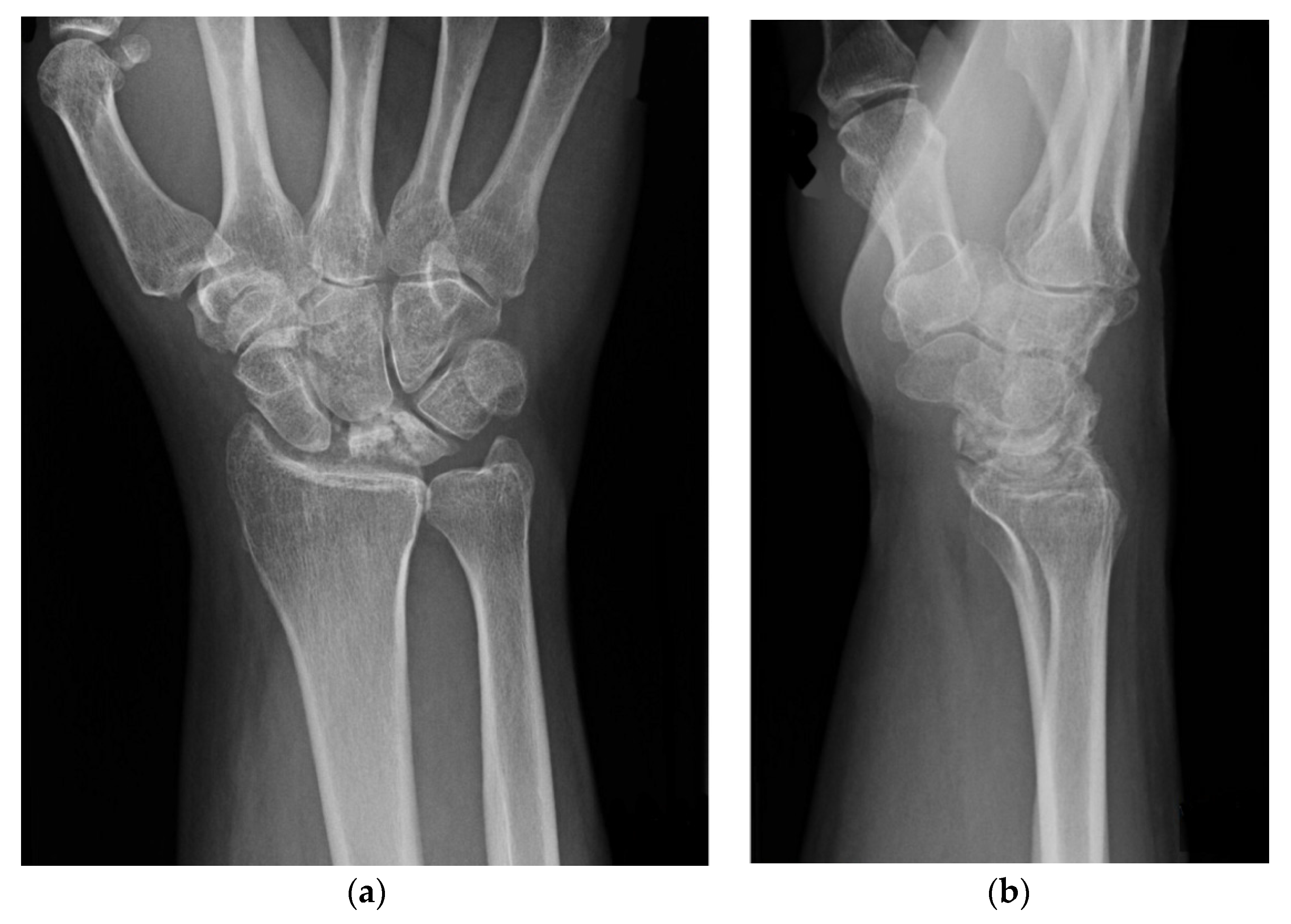 Jcm 11 00664 g003 550