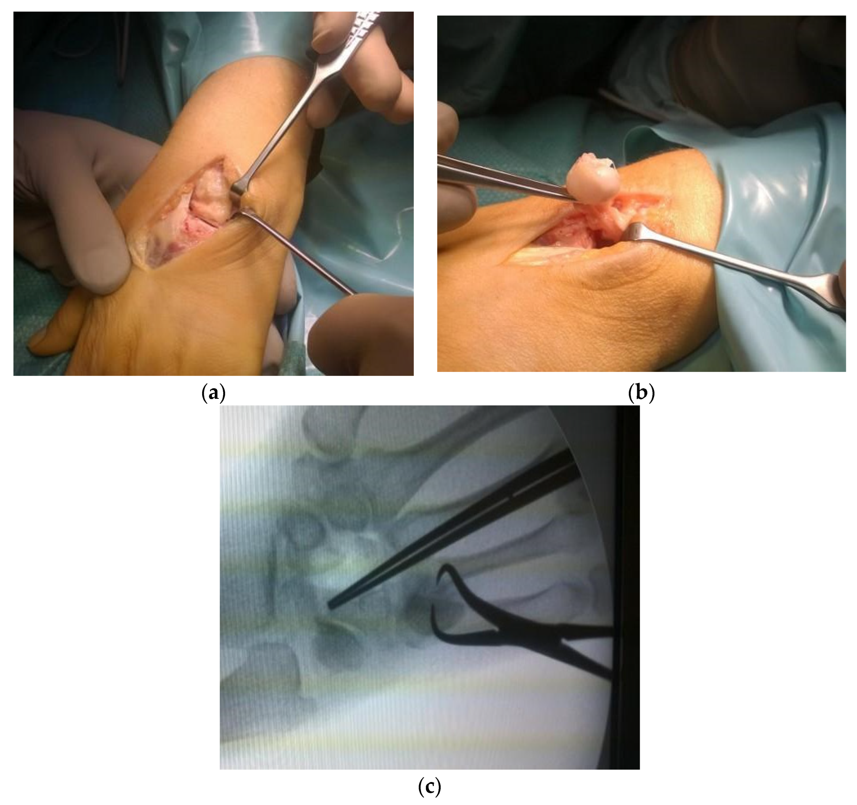 Jcm 11 00664 g004 550