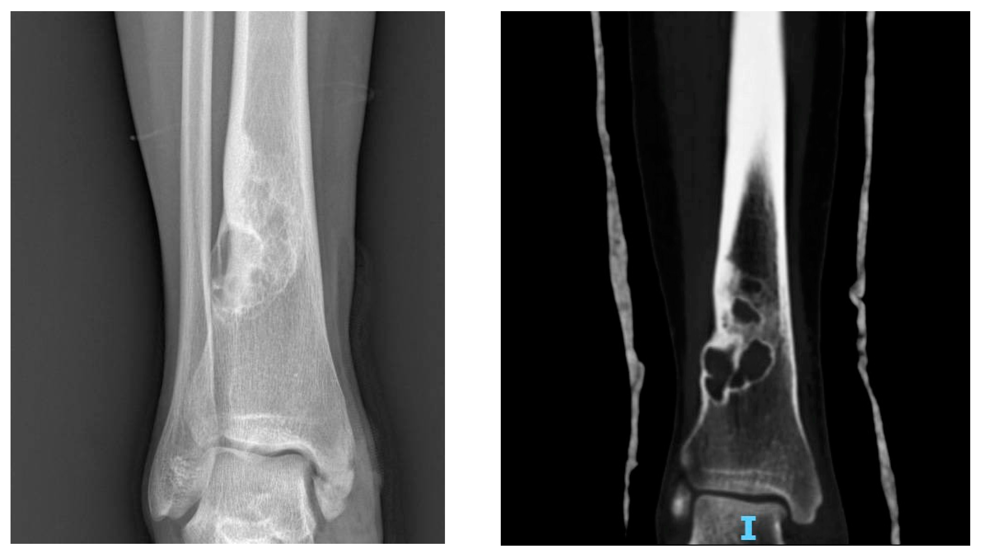 Jcm 11 00699 g004 550