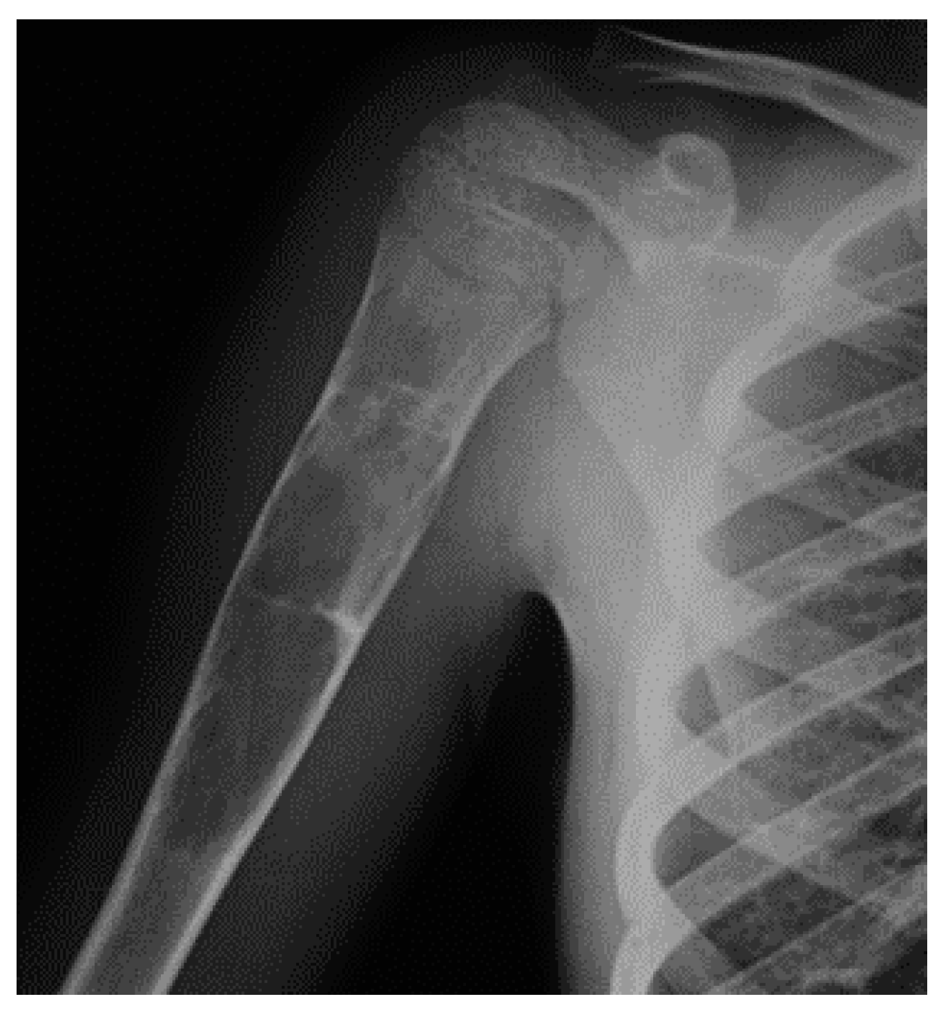 Jcm 11 00699 g005 550