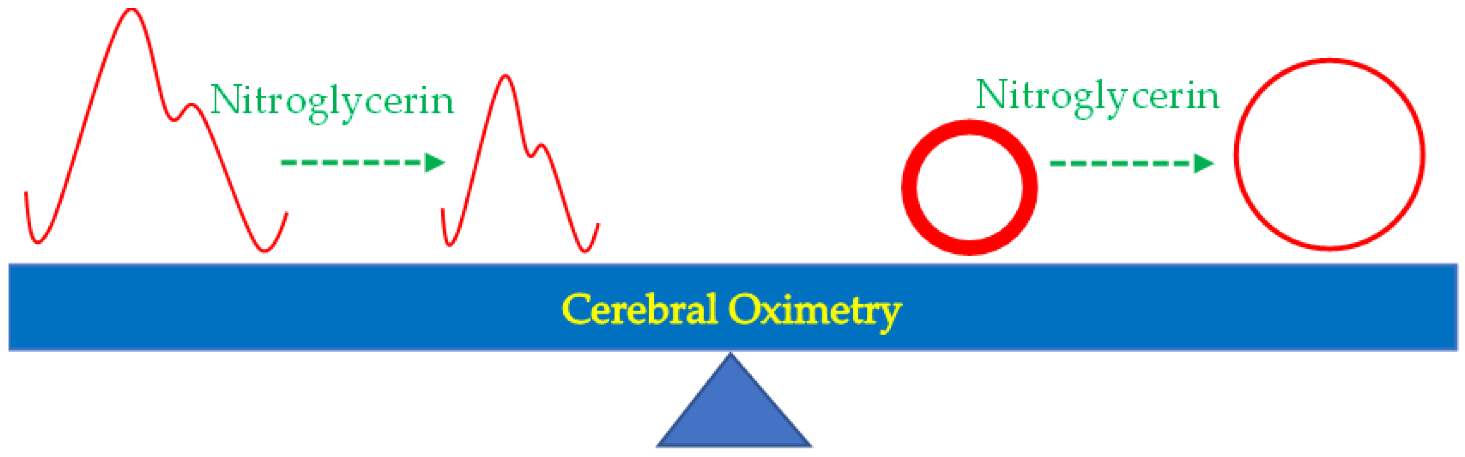 JCM Free FullText Cerebral OximetryMonitored Nitroglycerin
