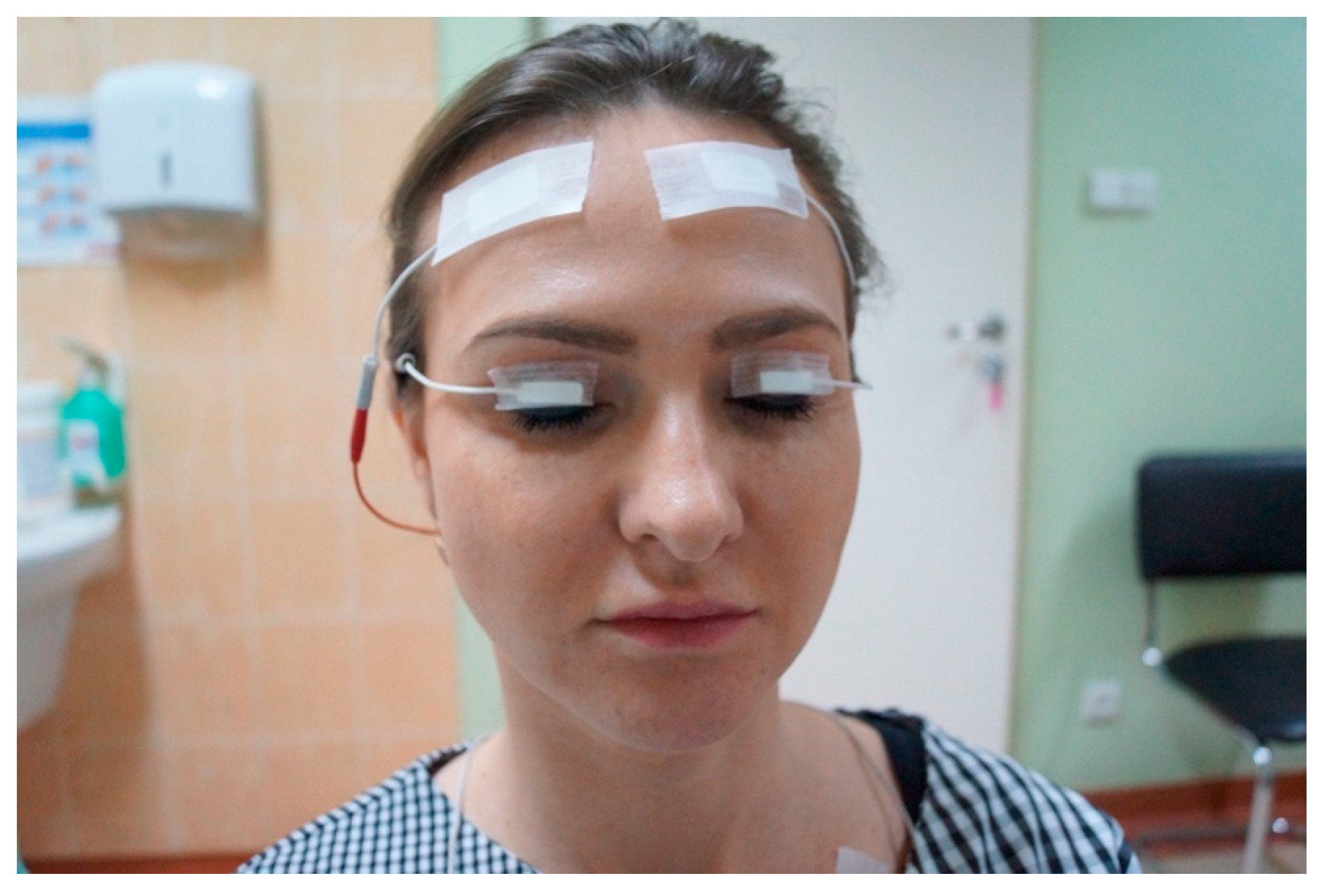 Jcm 11 00731 g001 Jcm 11 00731 g001