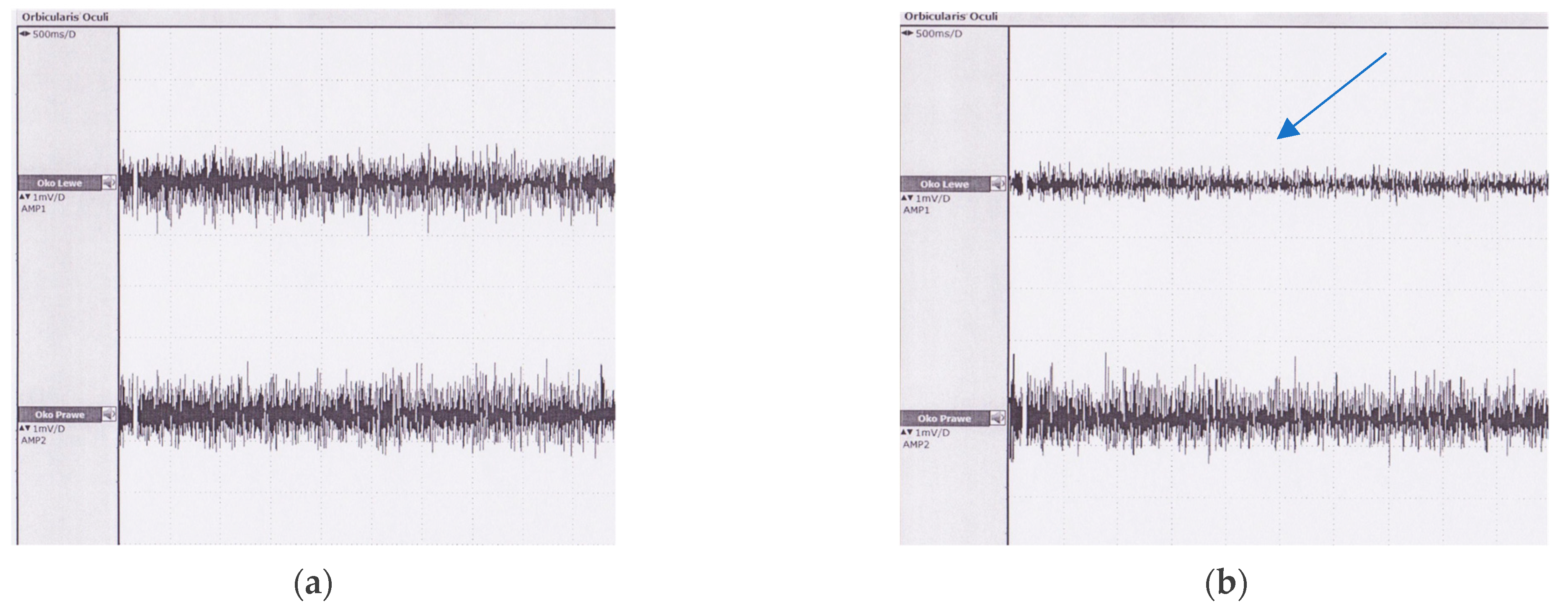 Jcm 11 00731 g003 Jcm 11 00731 g003