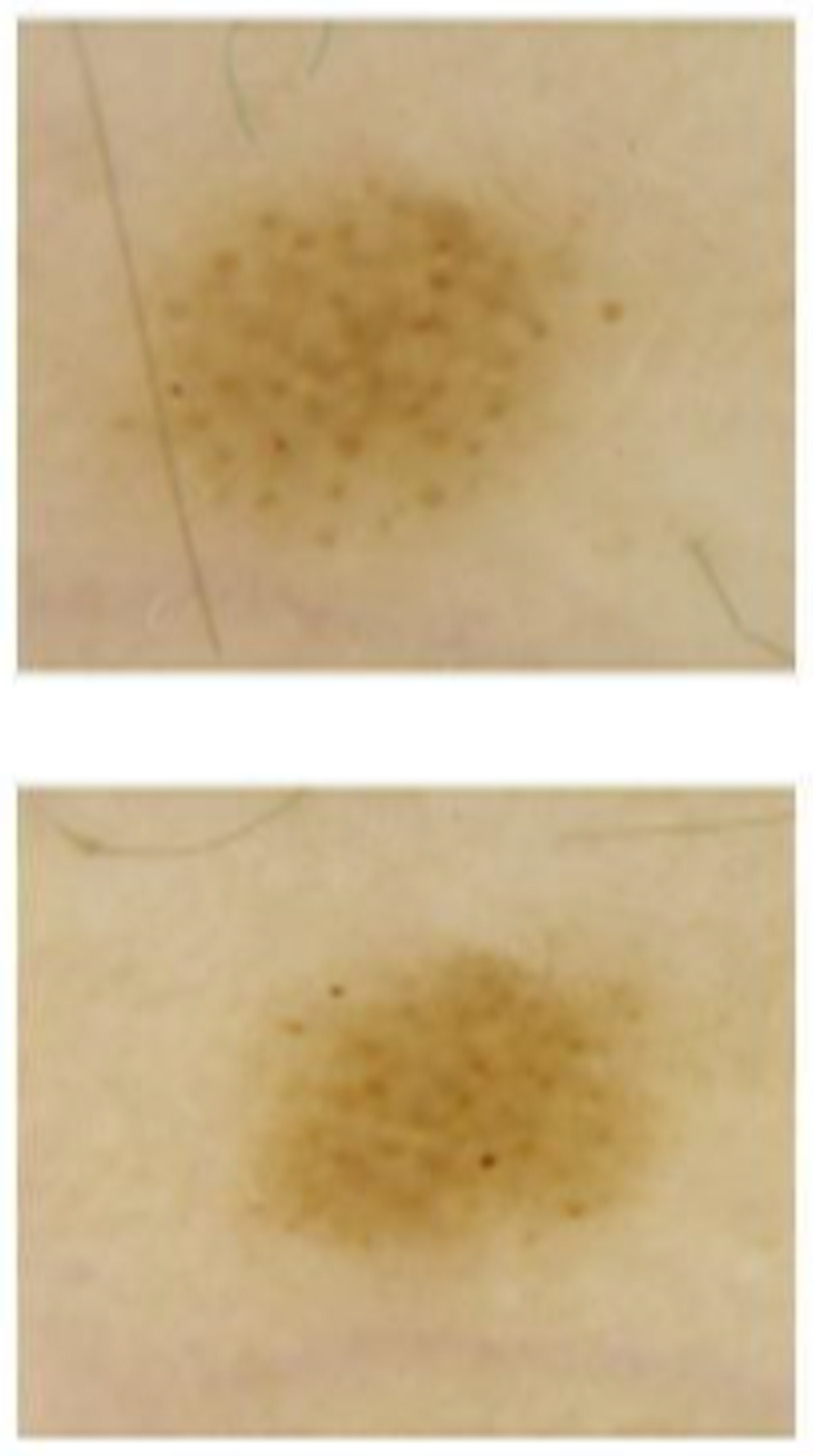 Jcm 11 00736 g003 Jcm 11 00736 g003