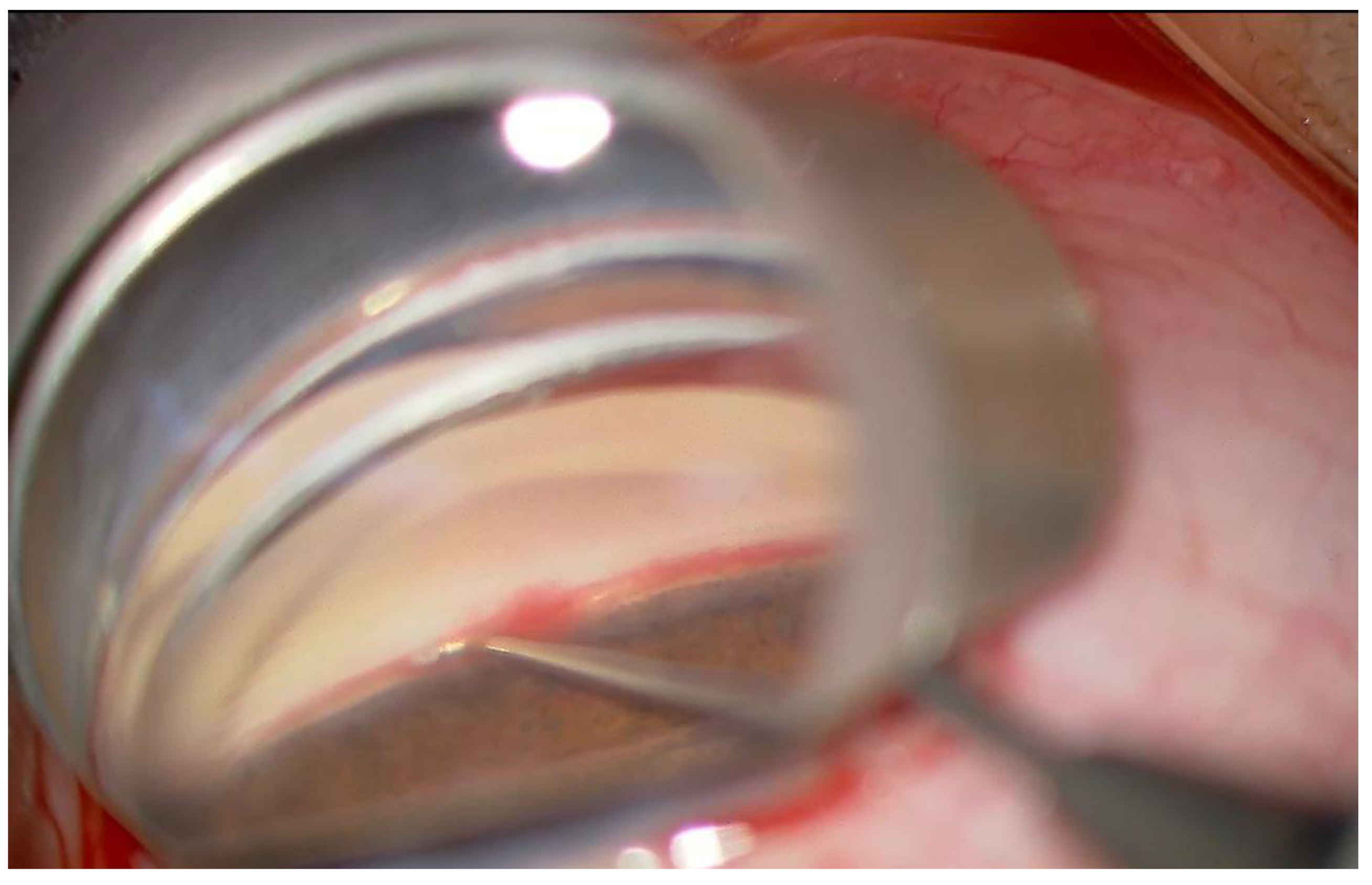 Jcm 11 00738 g001 Jcm 11 00738 g001