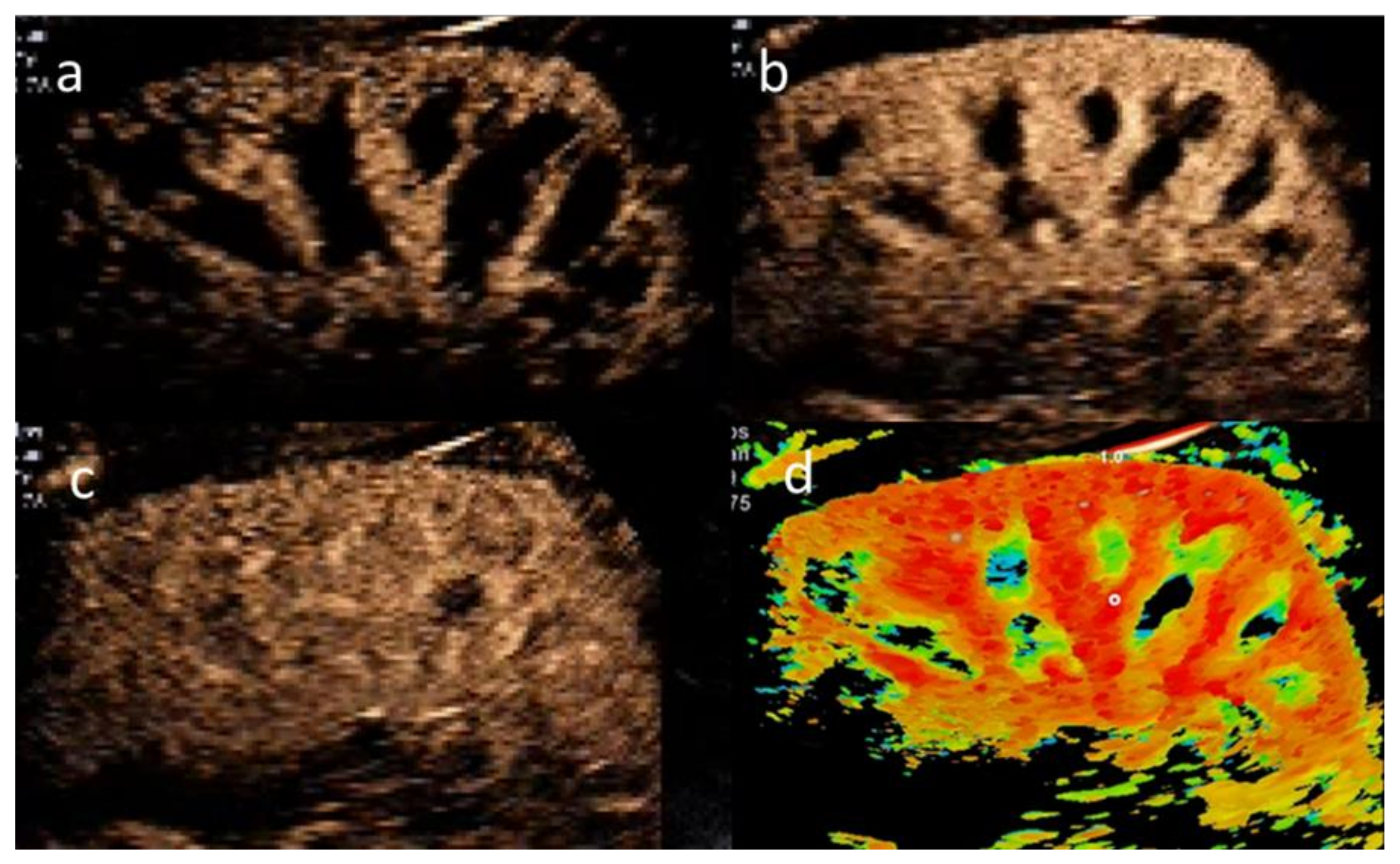 Jcm 11 00791 g001 550