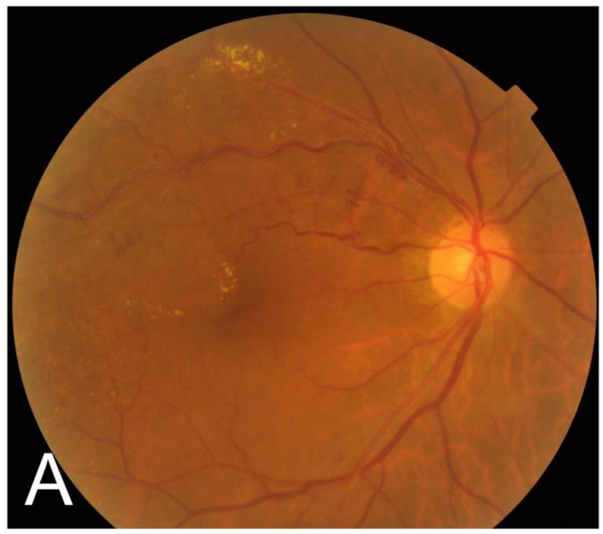 Jcm 11 00823 g001a 550