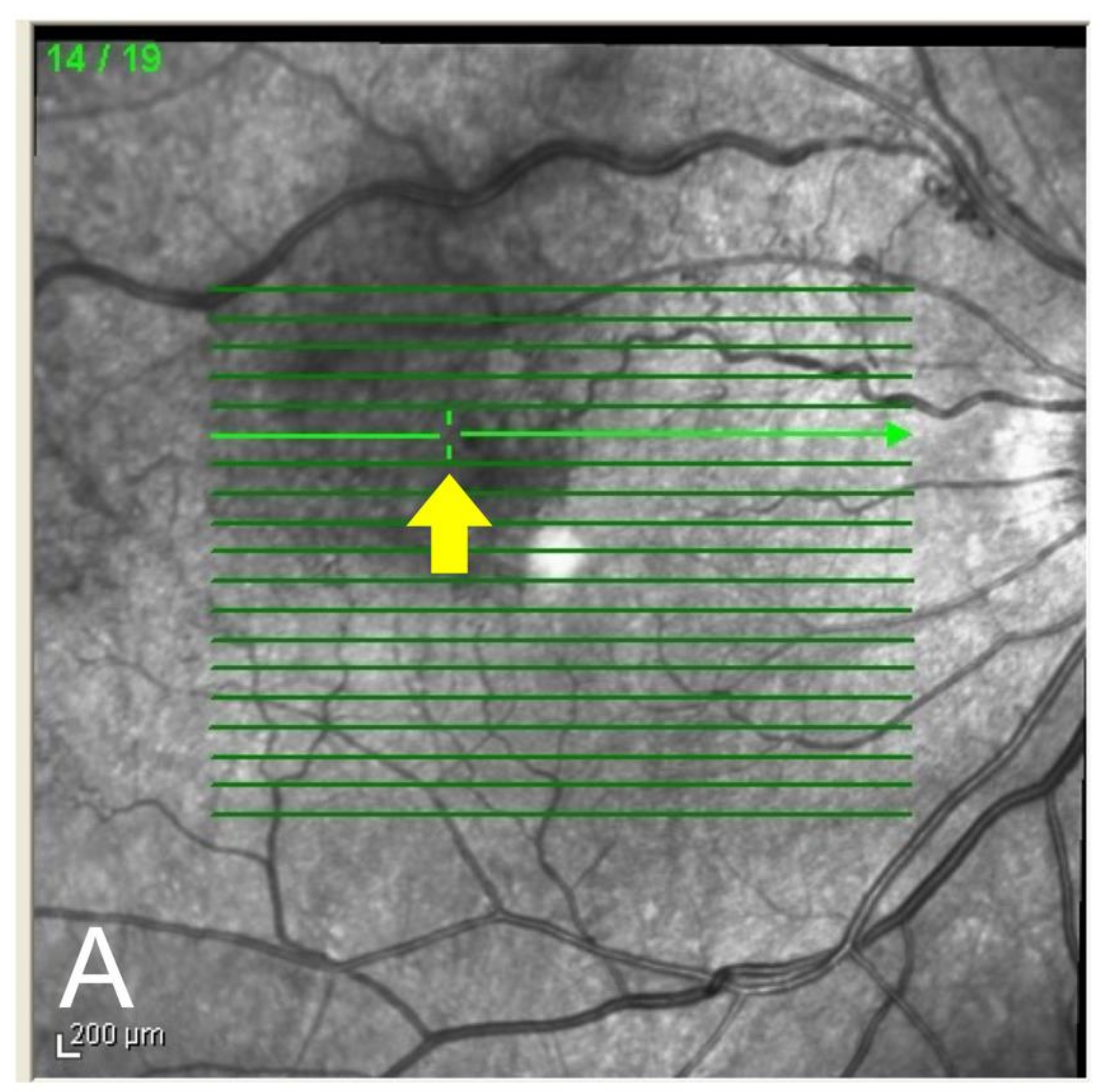 Jcm 11 00823 g002a 550