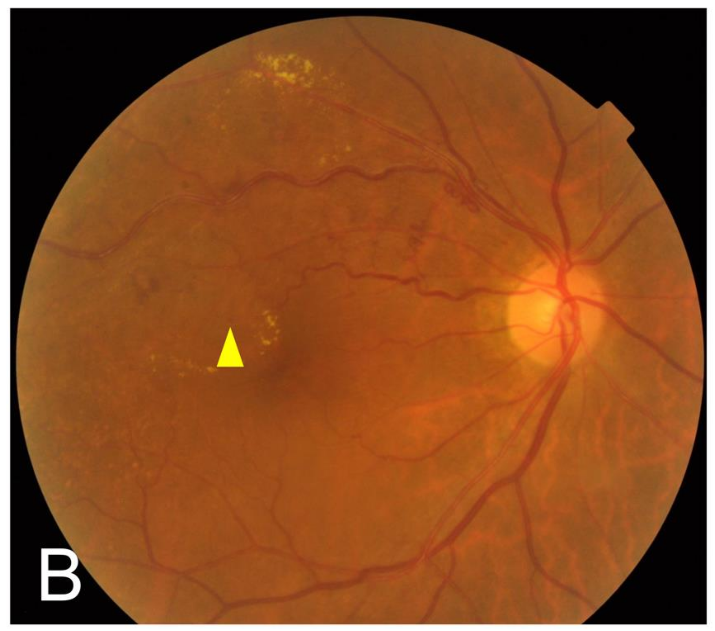 Jcm 11 00823 g002b 550