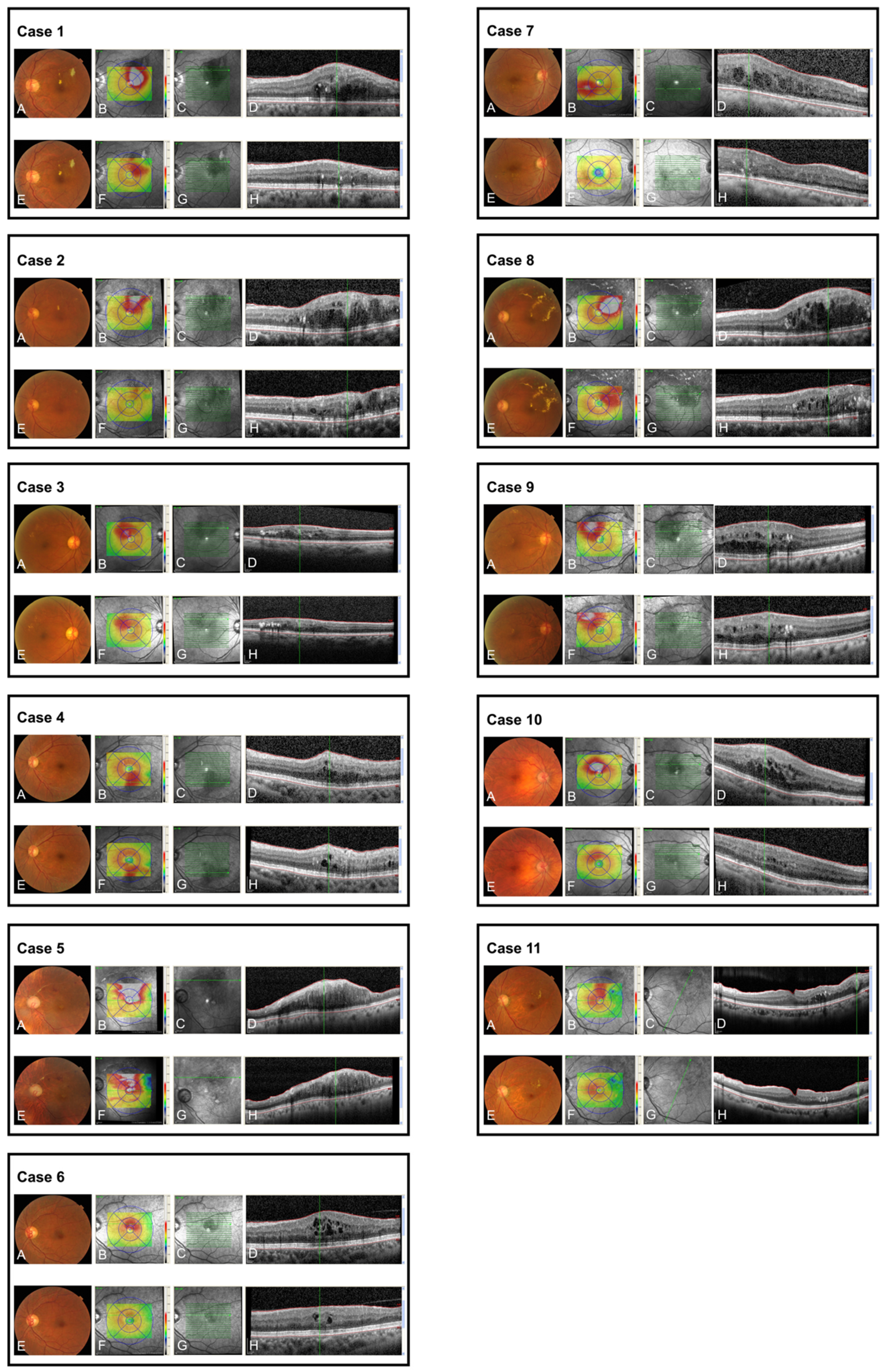 Jcm 11 00823 g003 550