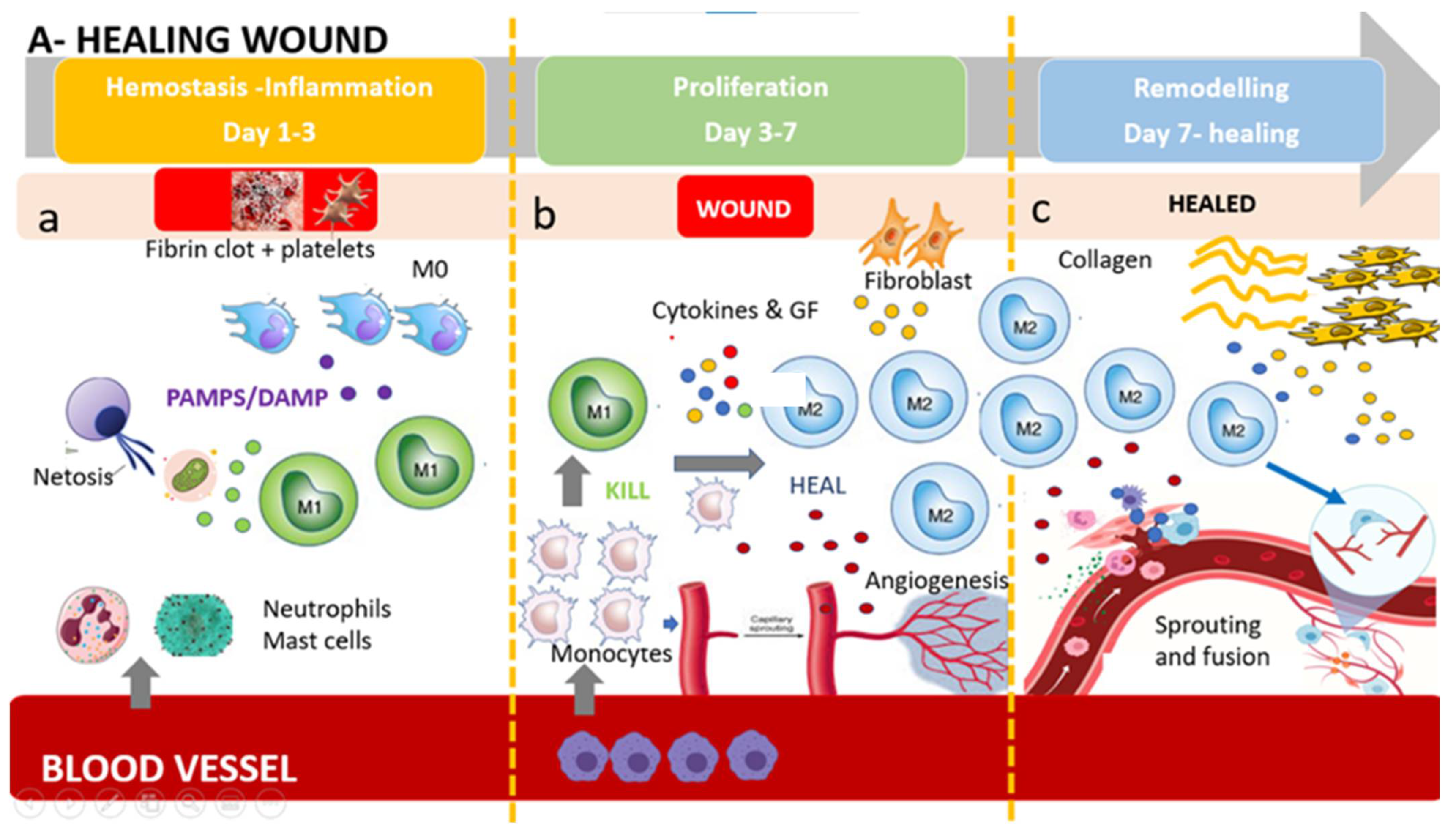 Stopping staph: Could it alter the course of diabetes? - The Loop