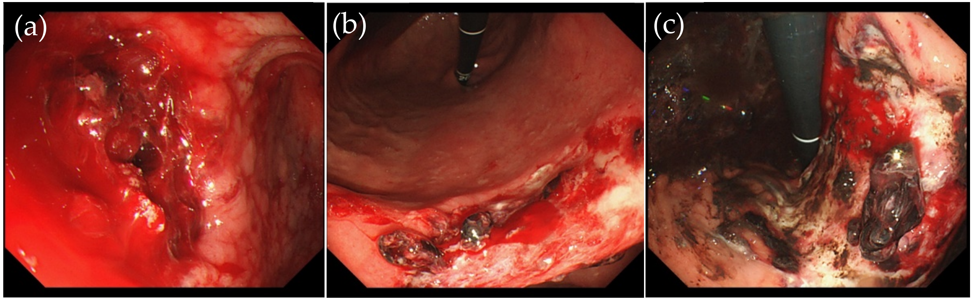 Jcm 11 00914 g001 550