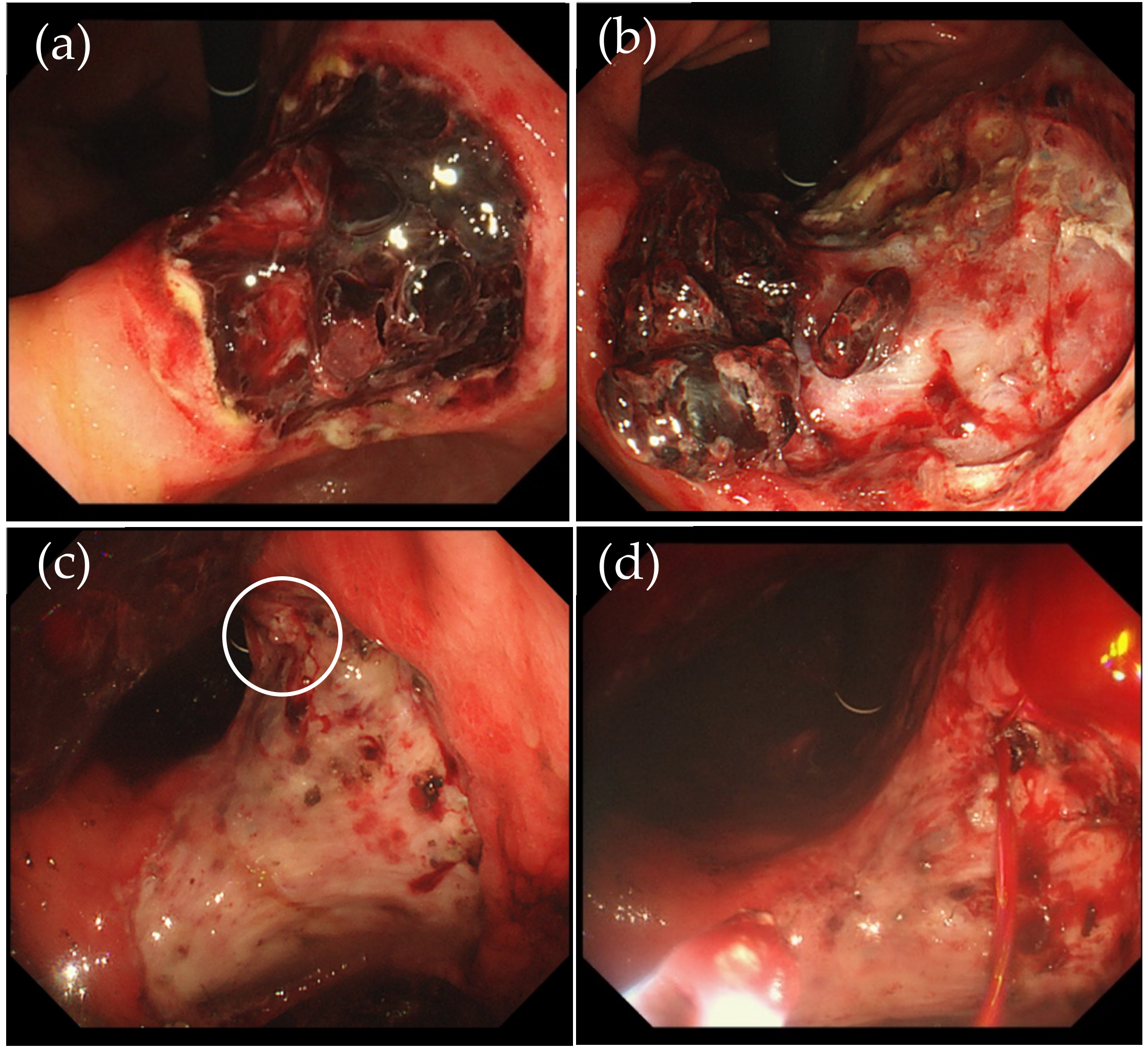 Jcm 11 00914 g002 550