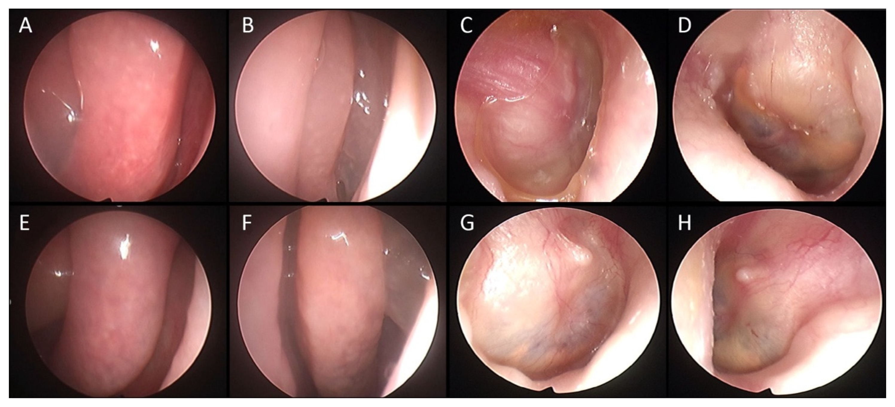 Jcm 11 00926 g002 Jcm 11 00926 g002