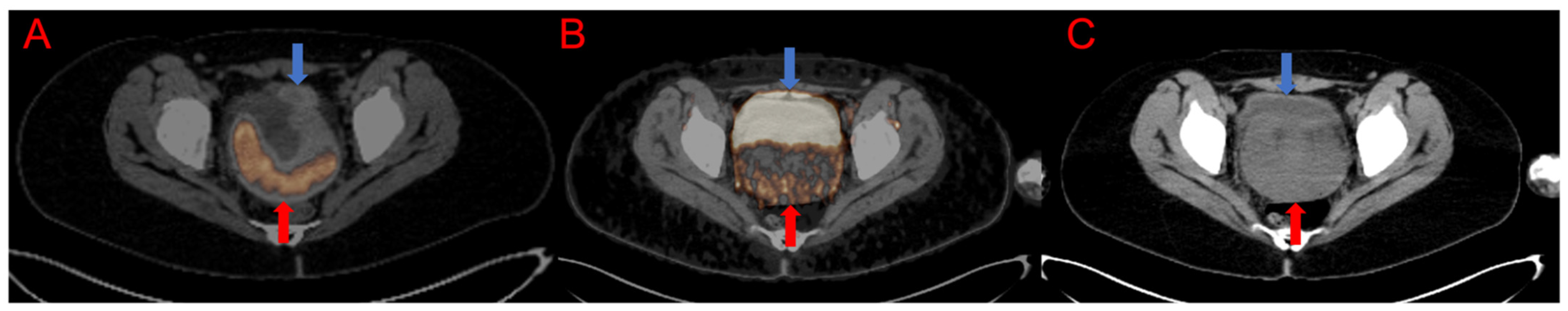 Jcm 11 00962 g002 550