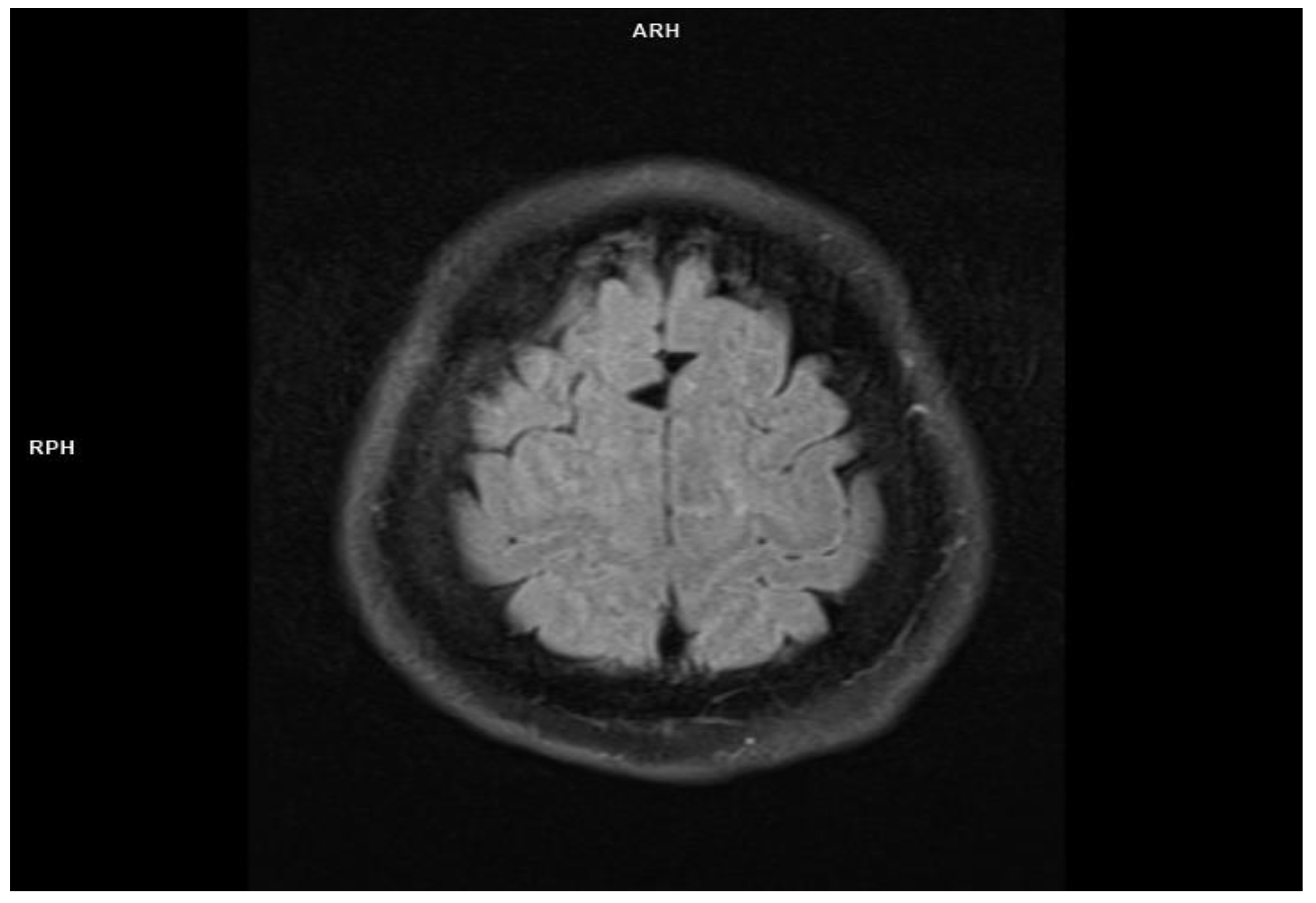 Jcm 11 00981 g002 550