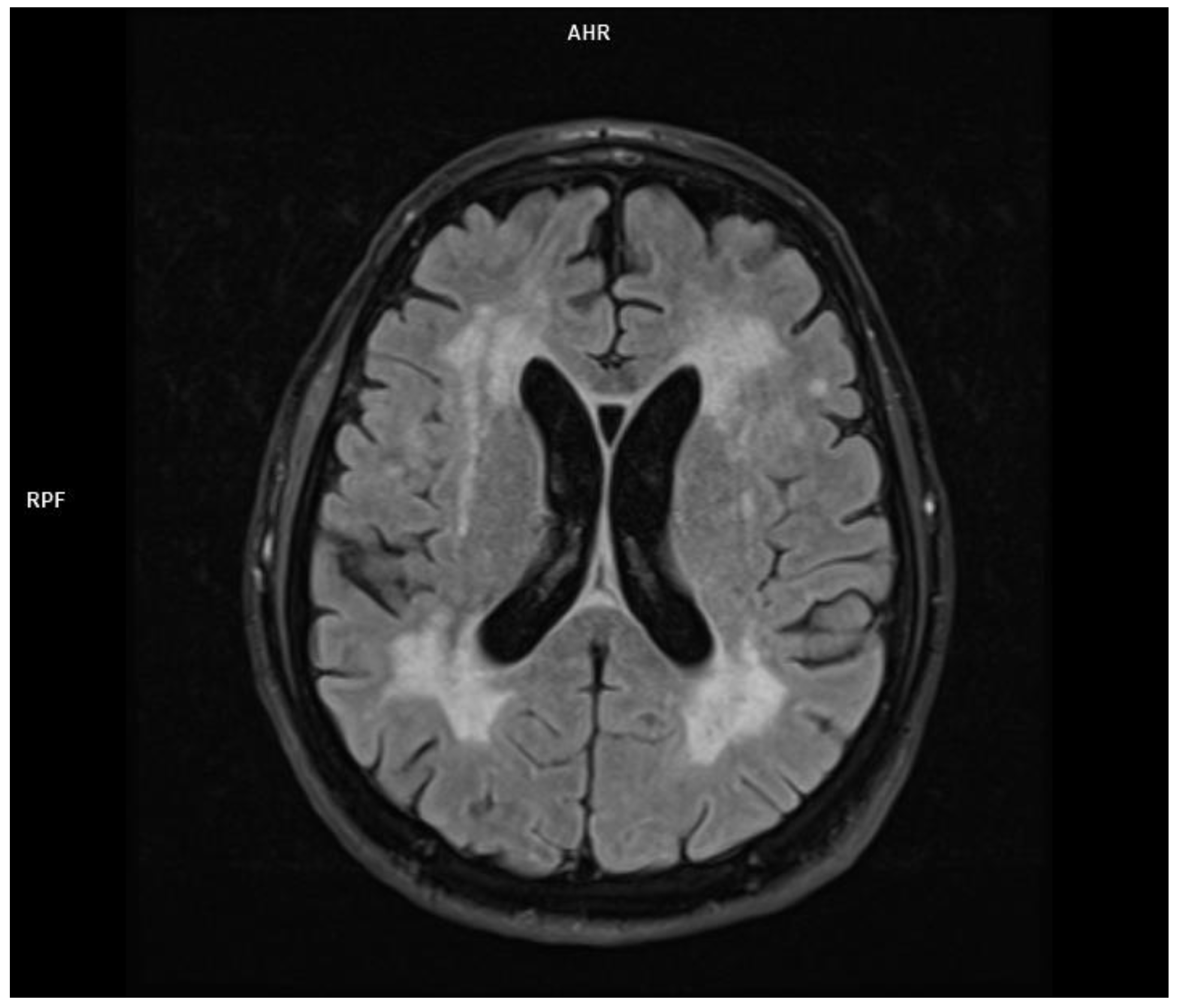 Jcm 11 00981 g003 550