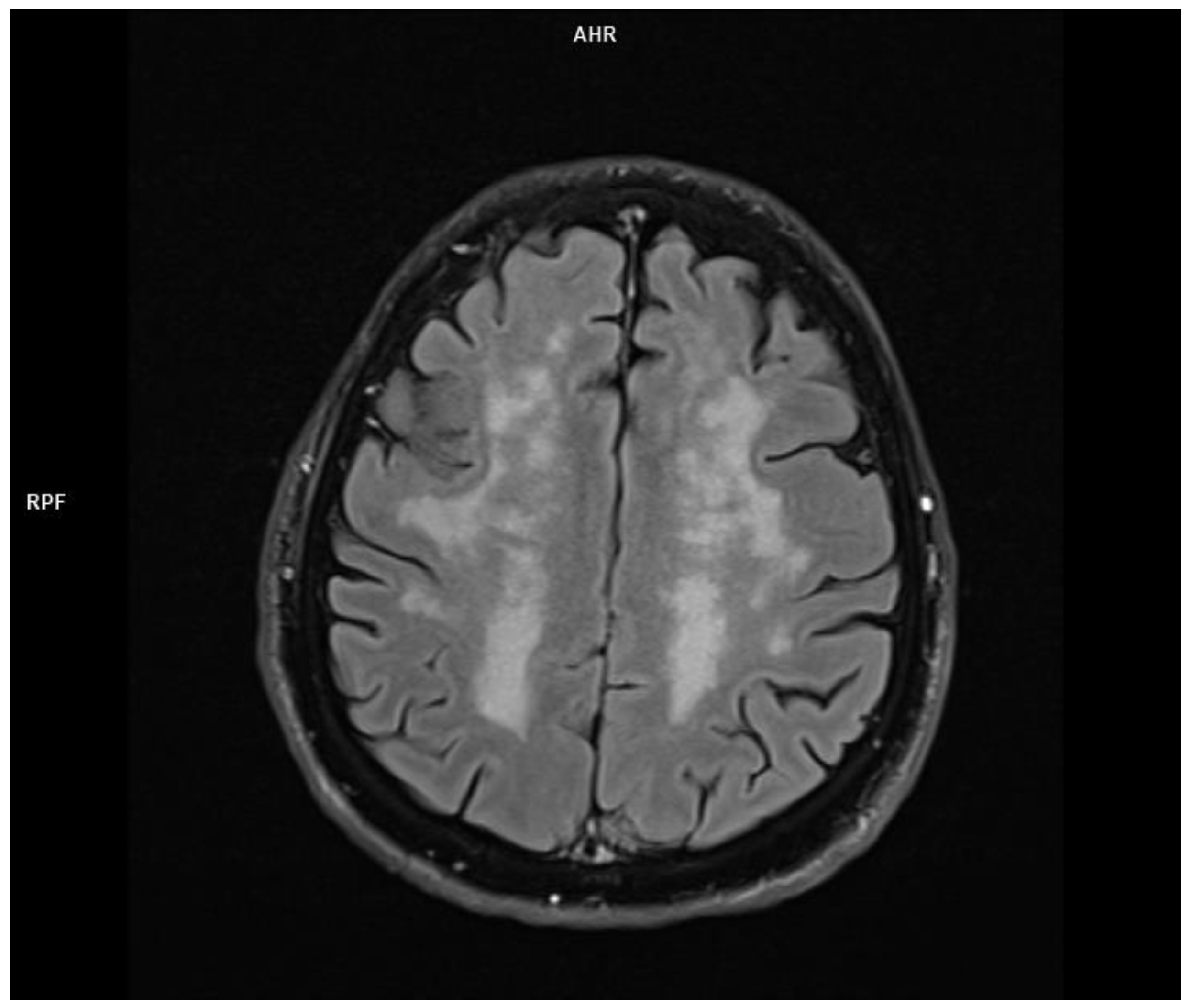 Jcm 11 00981 g004 550