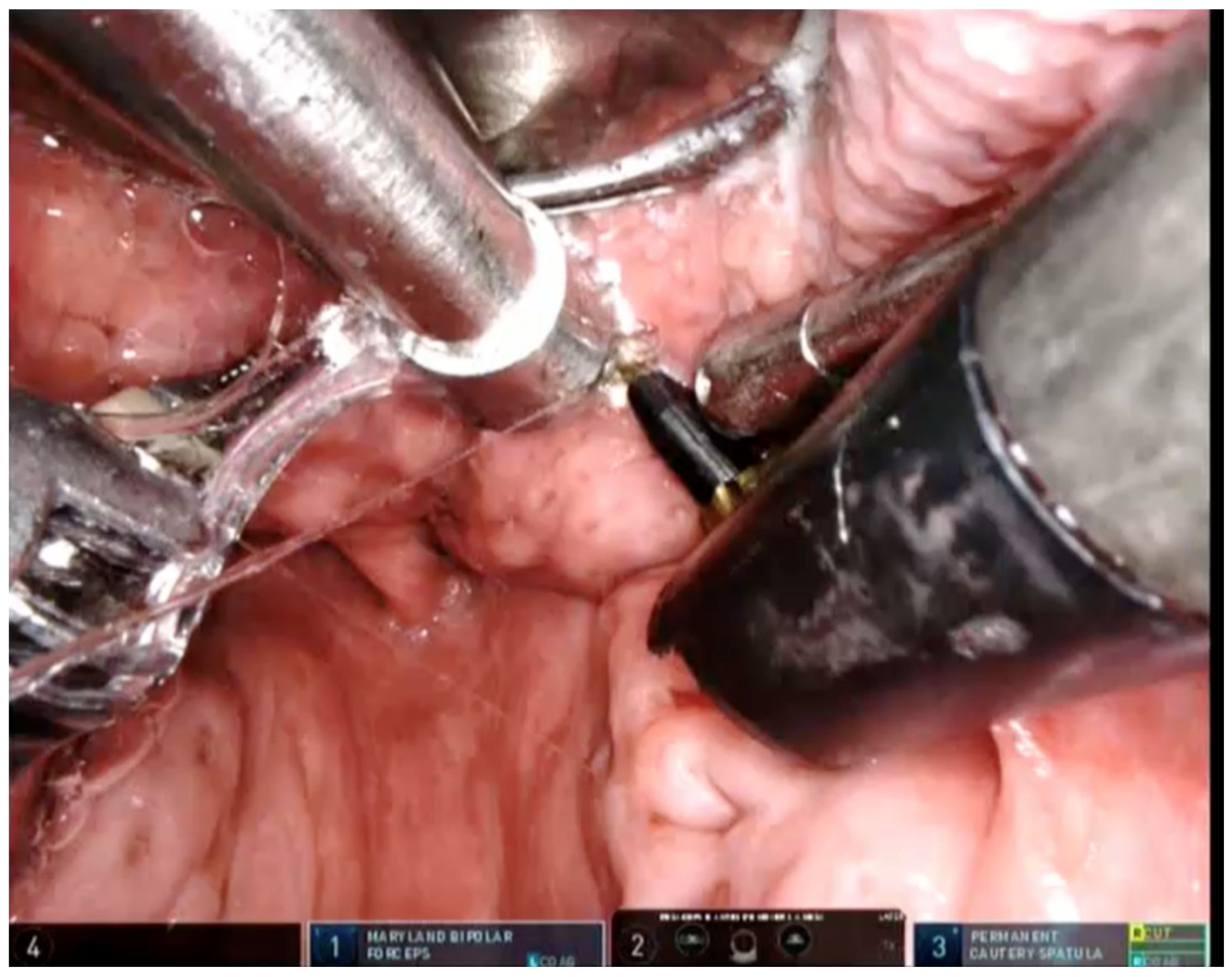 Jcm 11 00990 g001 550