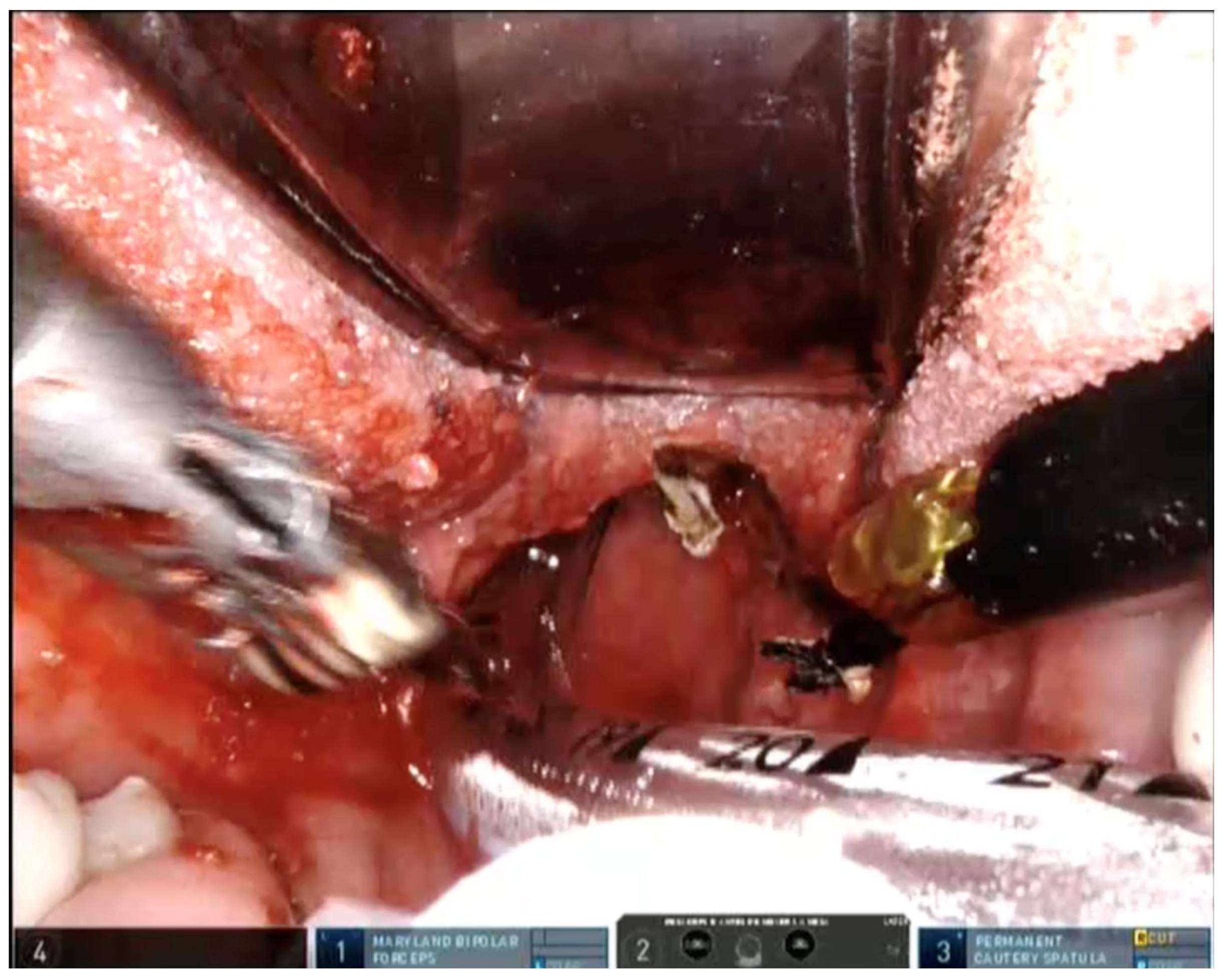 Jcm 11 00990 g002 550