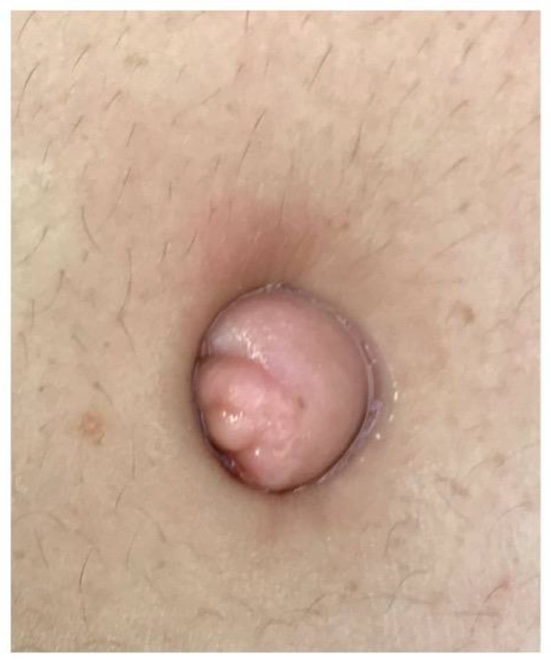 Jcm 11 00995 g002 Jcm 11 00995 g002