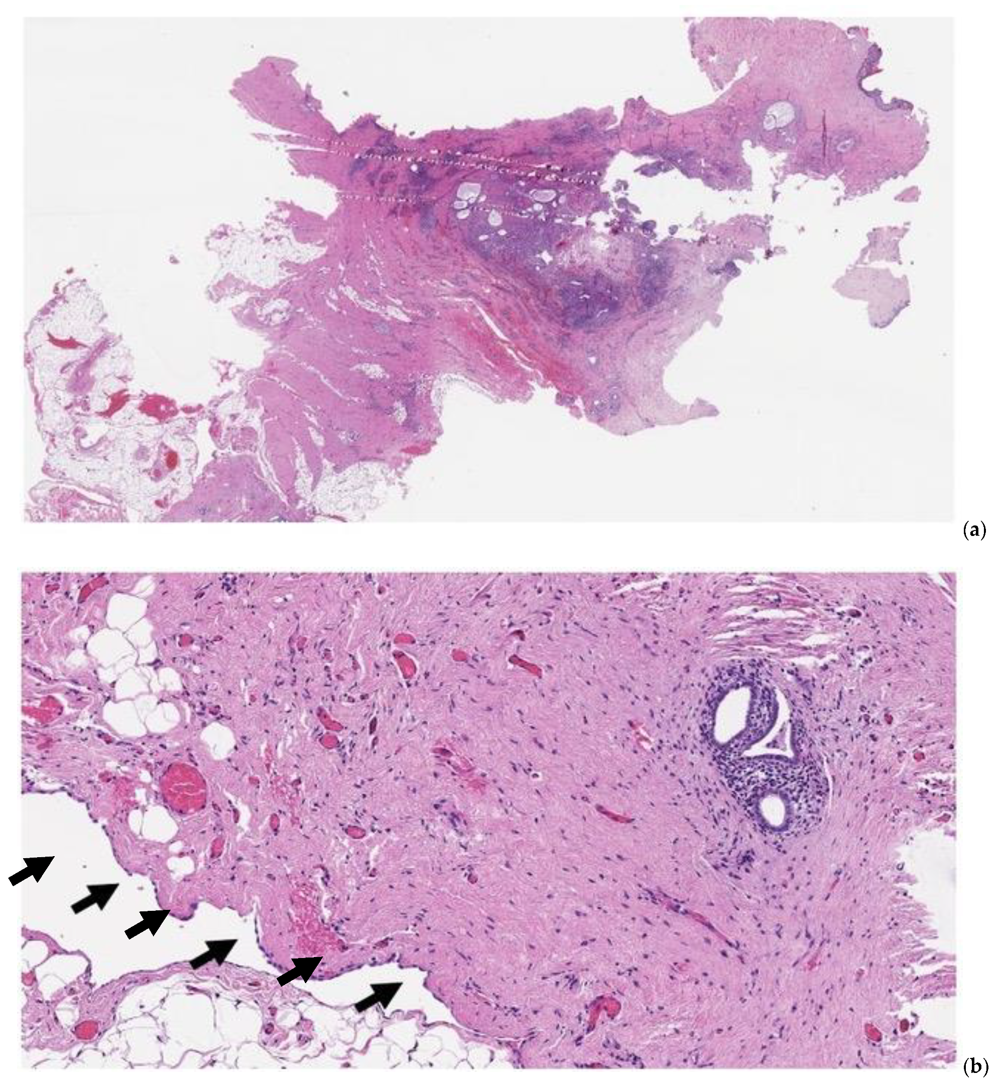 Jcm 11 00995 g004 Jcm 11 00995 g004