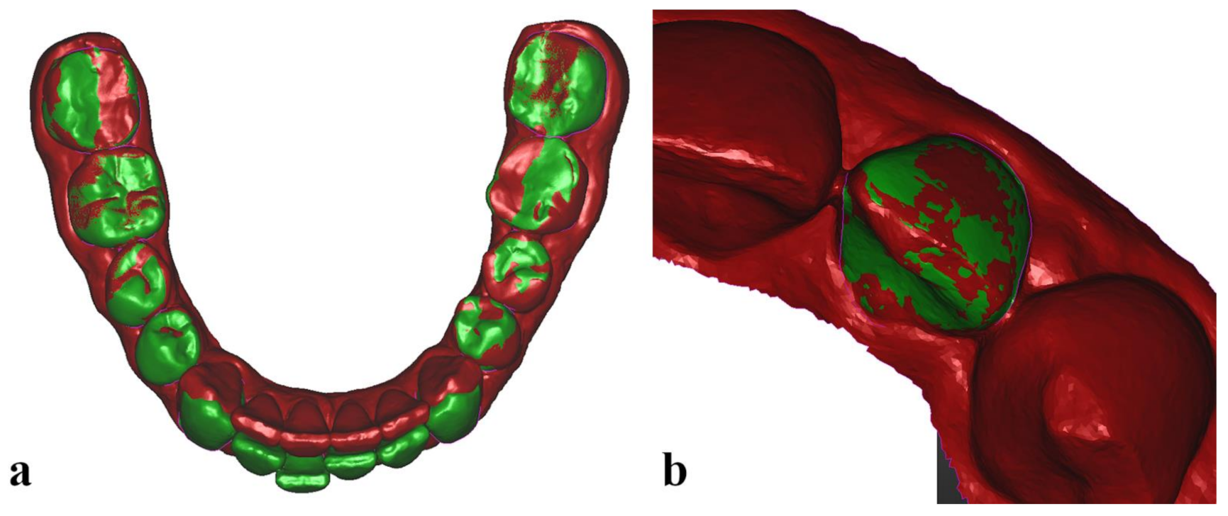 Jcm 11 01016 g001 550