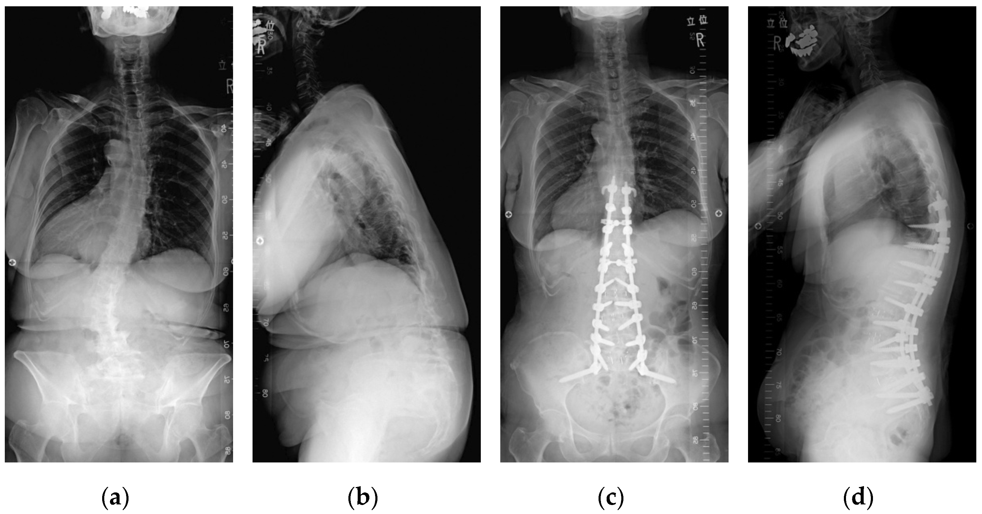 Jcm 11 01020 g001 550