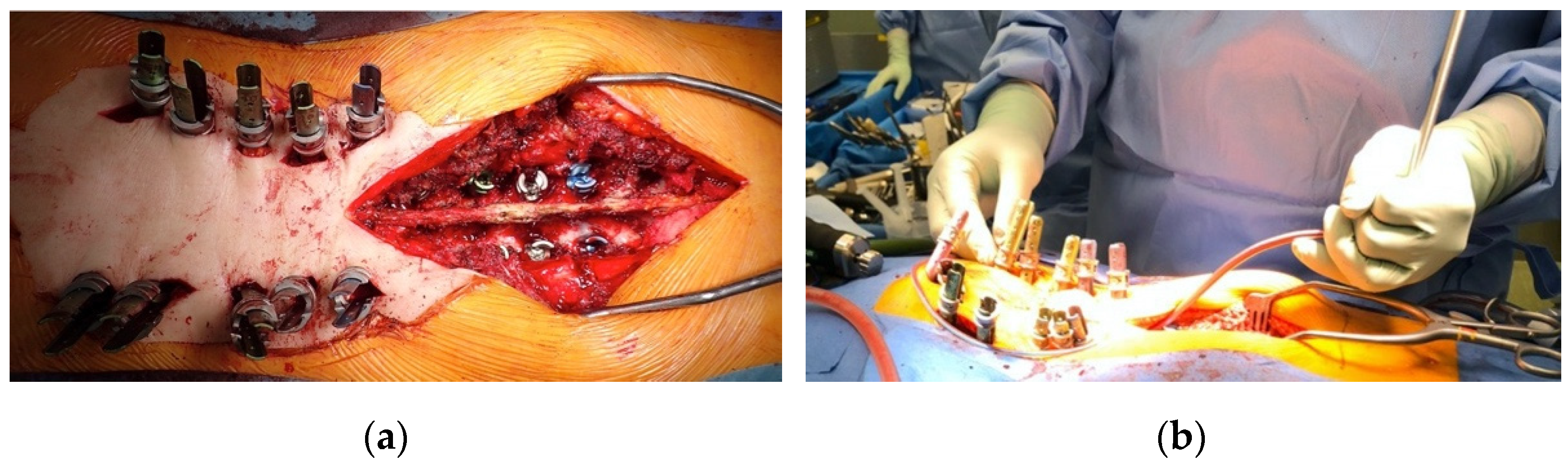 Jcm 11 01020 g002 550