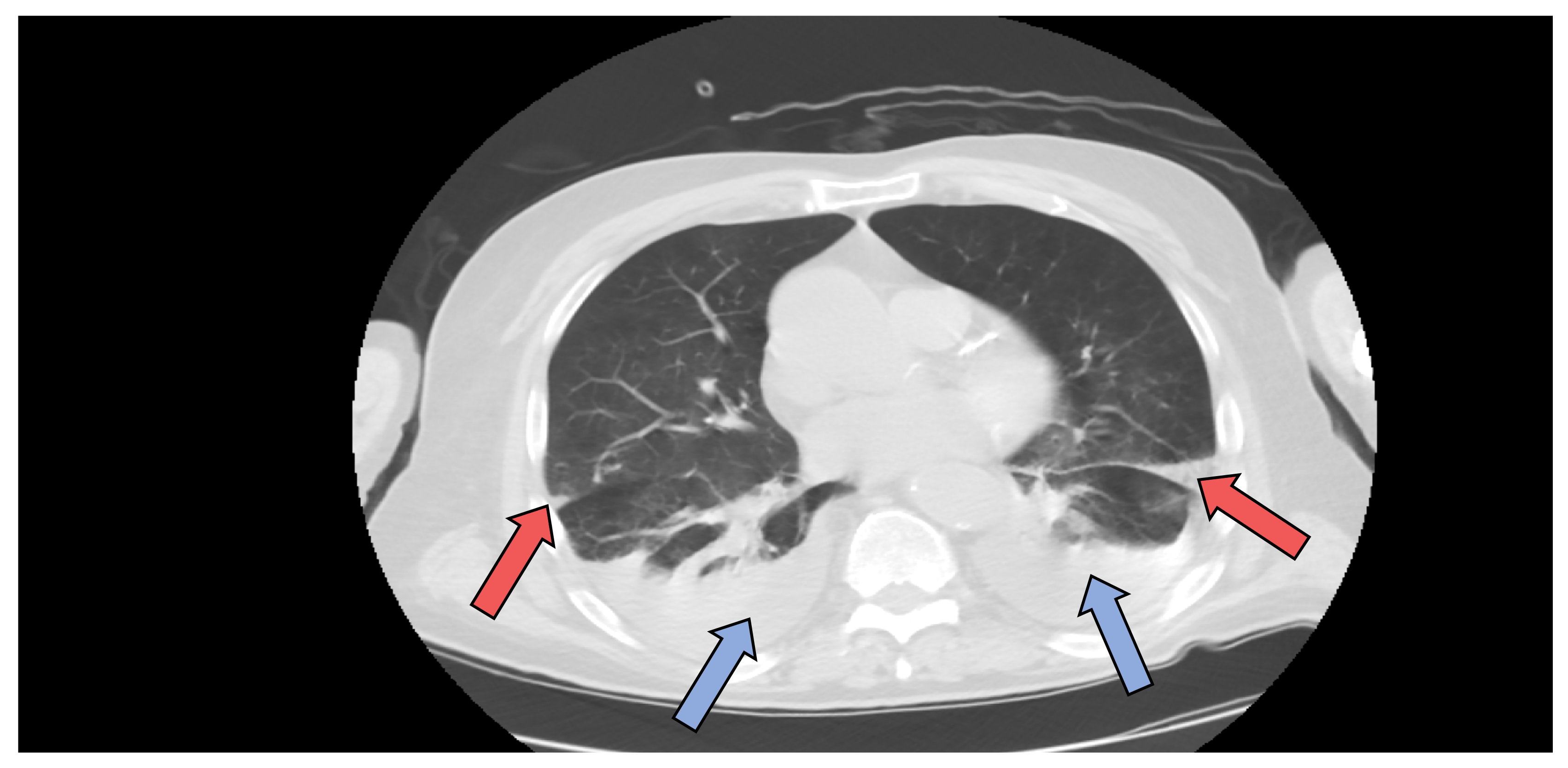 Jcm 11 01088 g003 550