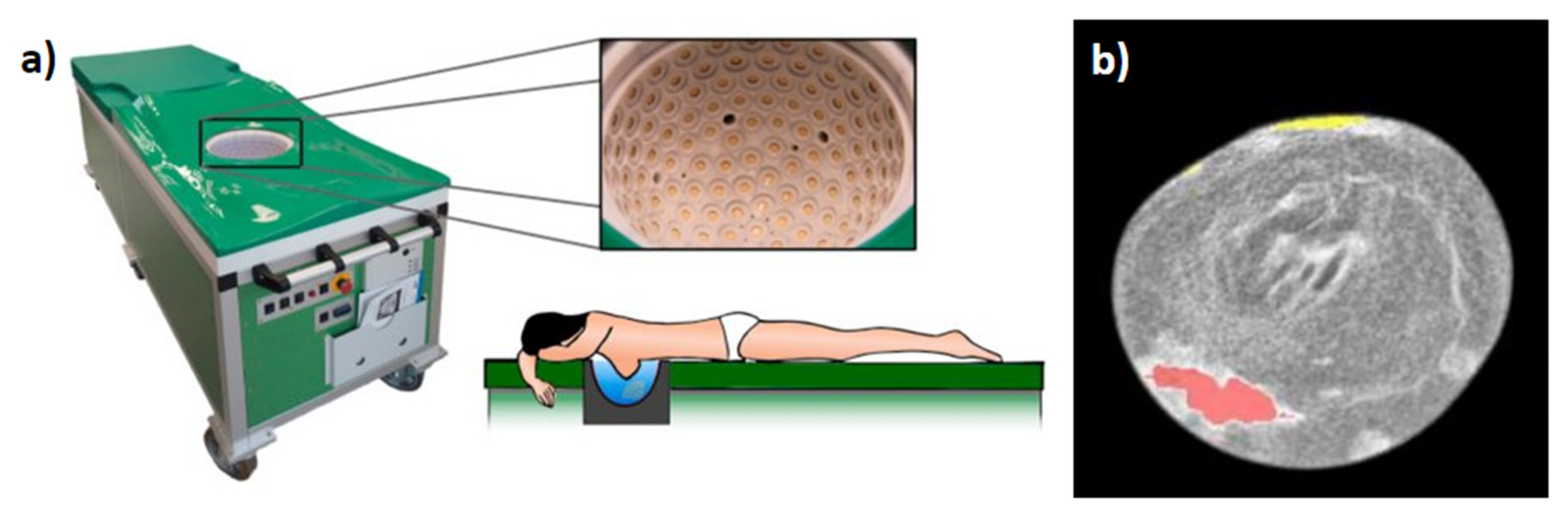 Jcm 11 01165 g004 550