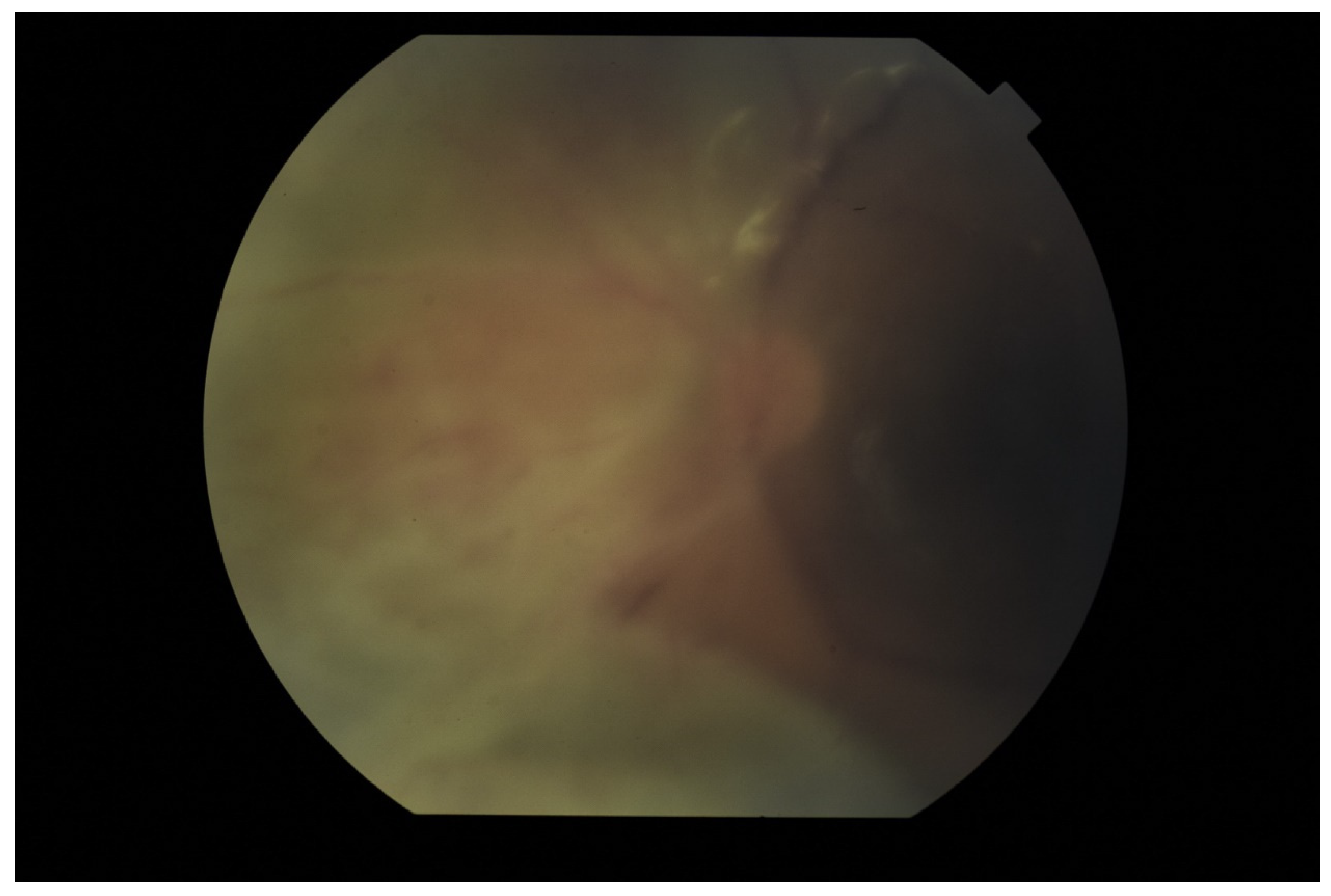 Jcm 11 01183 g001 Jcm 11 01183 g001