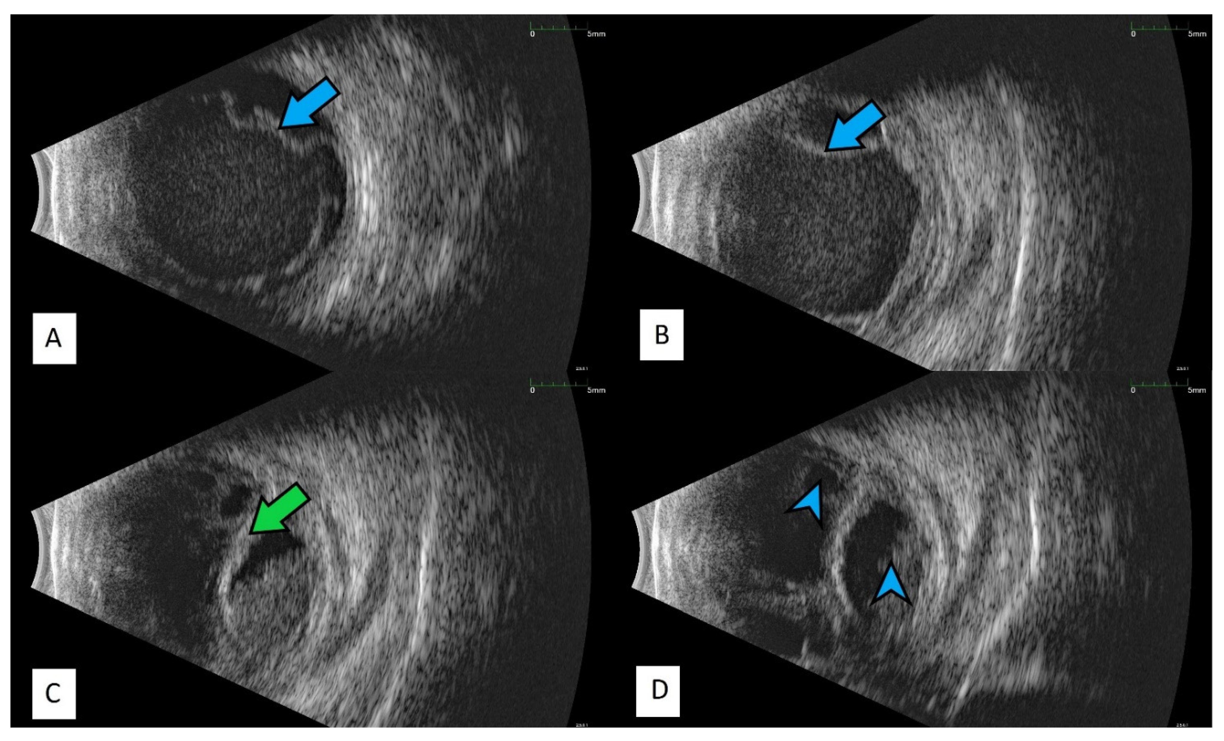 Jcm 11 01183 g008 Jcm 11 01183 g008