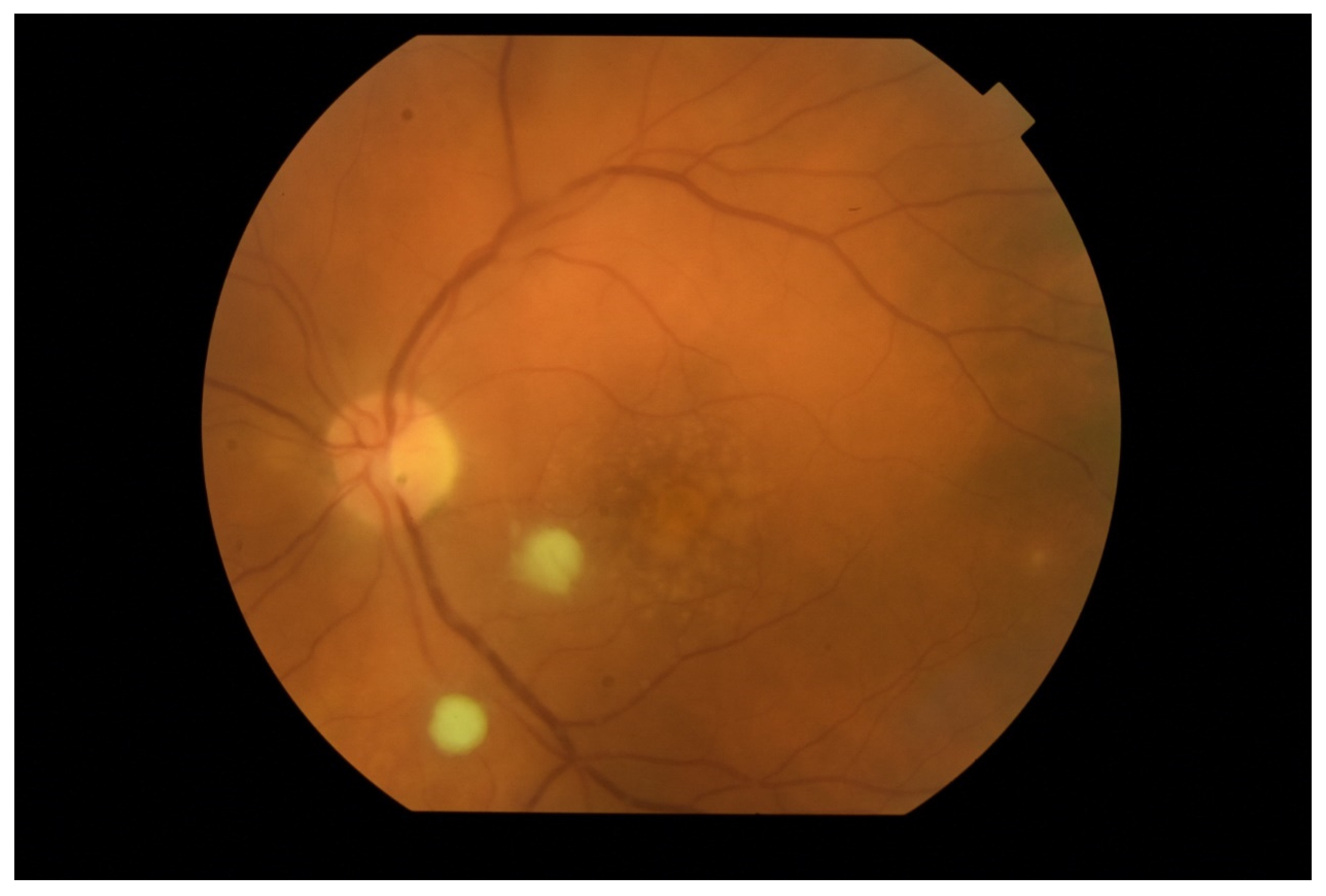 Jcm 11 01183 g011 Jcm 11 01183 g011