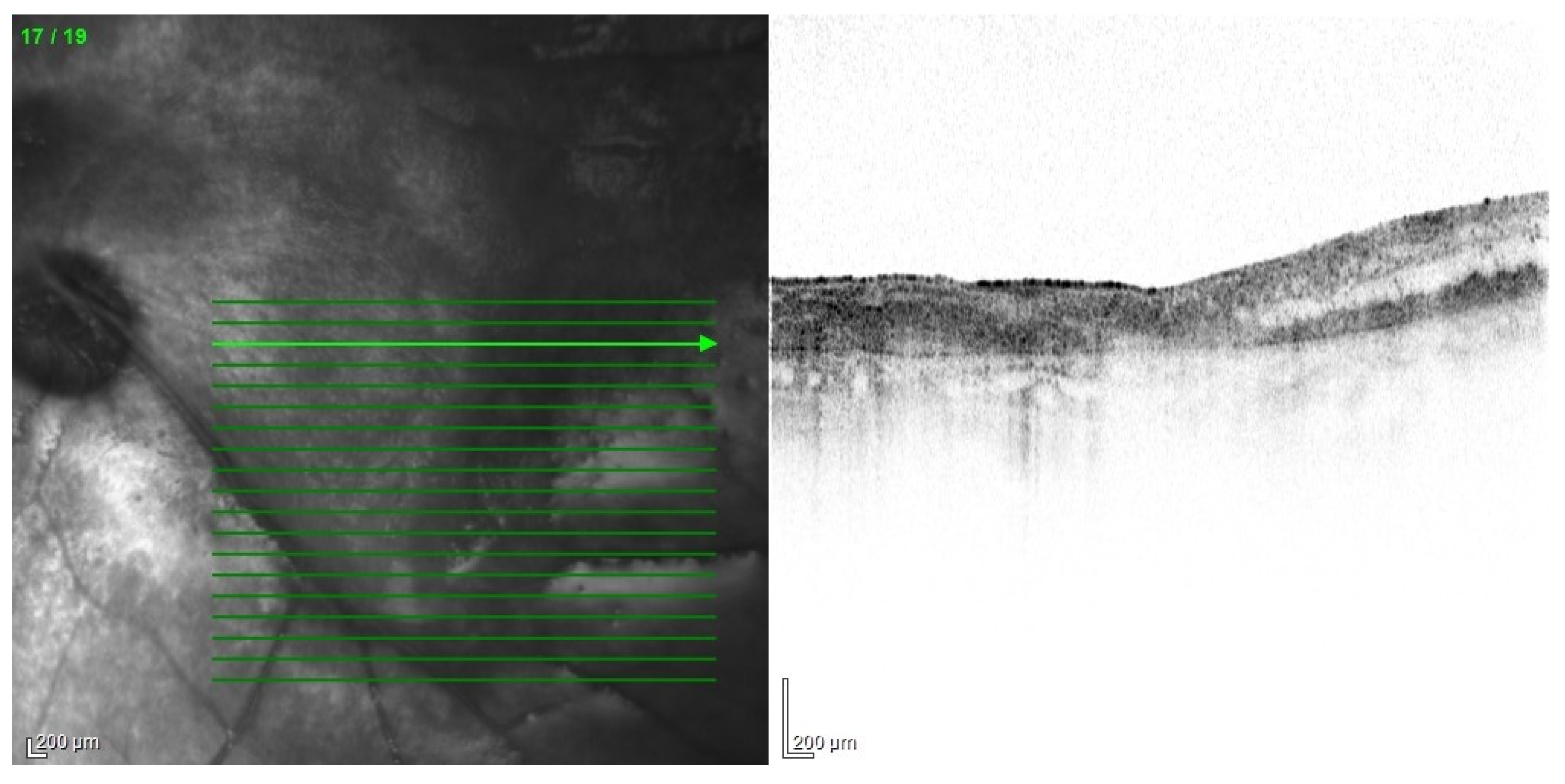 Jcm 11 01183 g013 Jcm 11 01183 g013