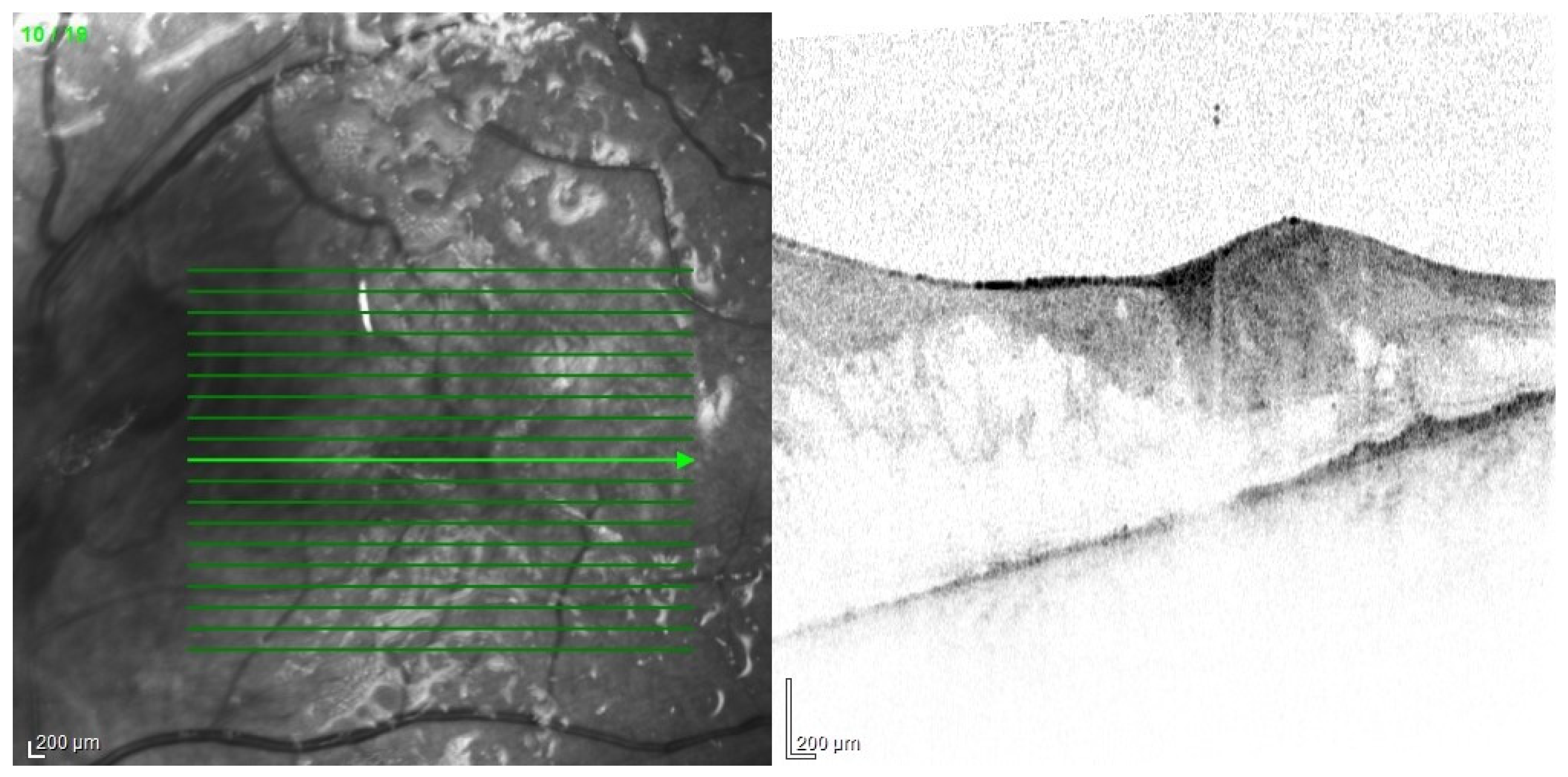 Jcm 11 01183 g017 Jcm 11 01183 g017