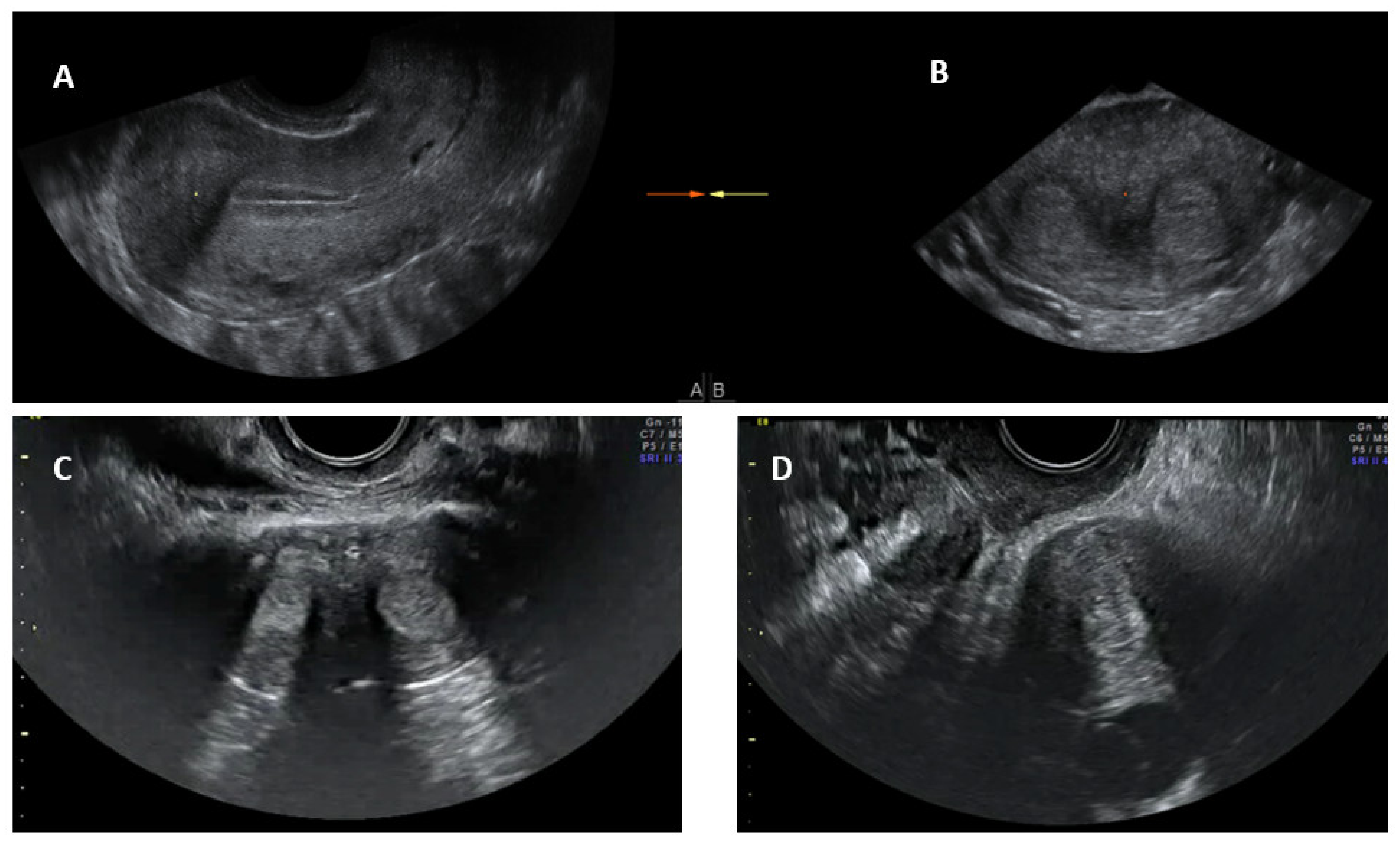 Jcm 11 01251 g004 550