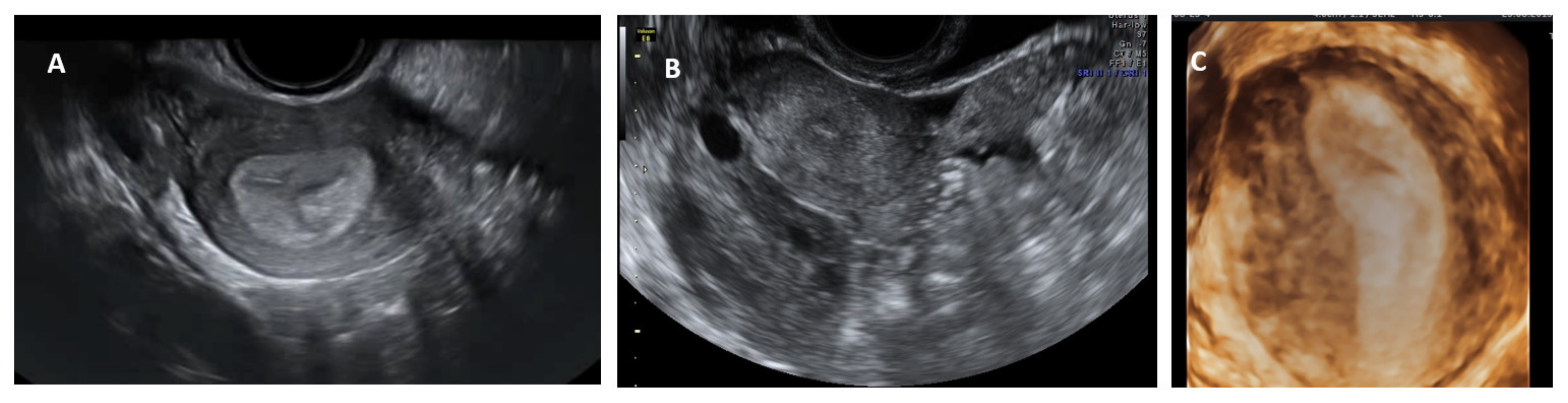 Jcm 11 01251 g005 550