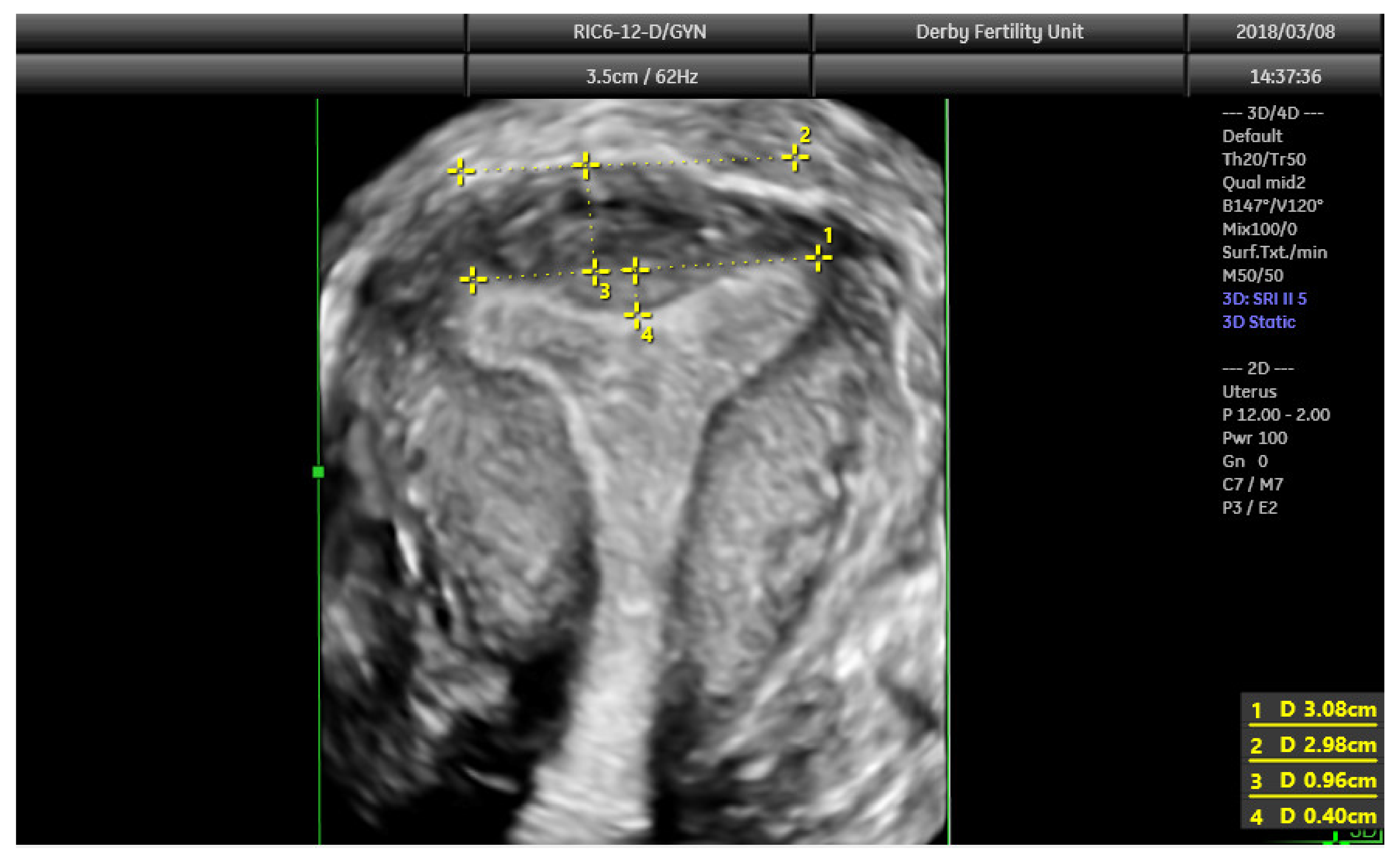 Jcm 11 01251 g009 550
