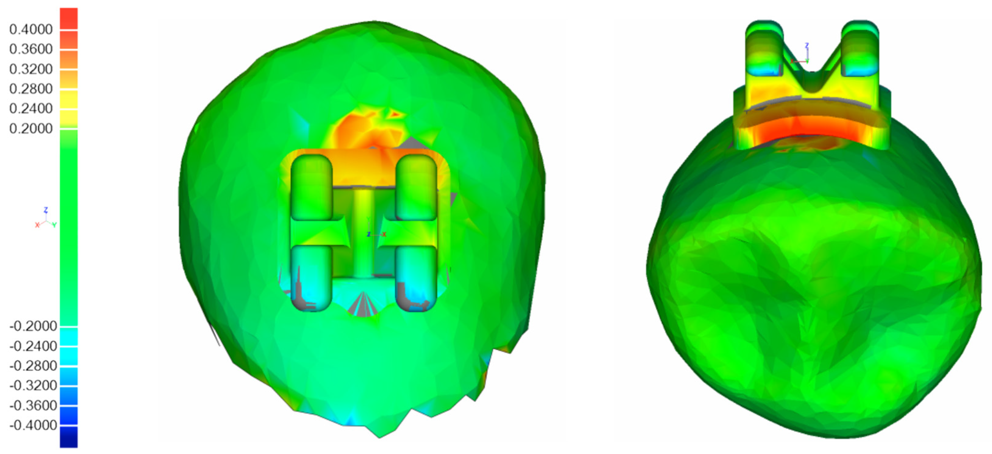 Jcm 11 01295 g005 550