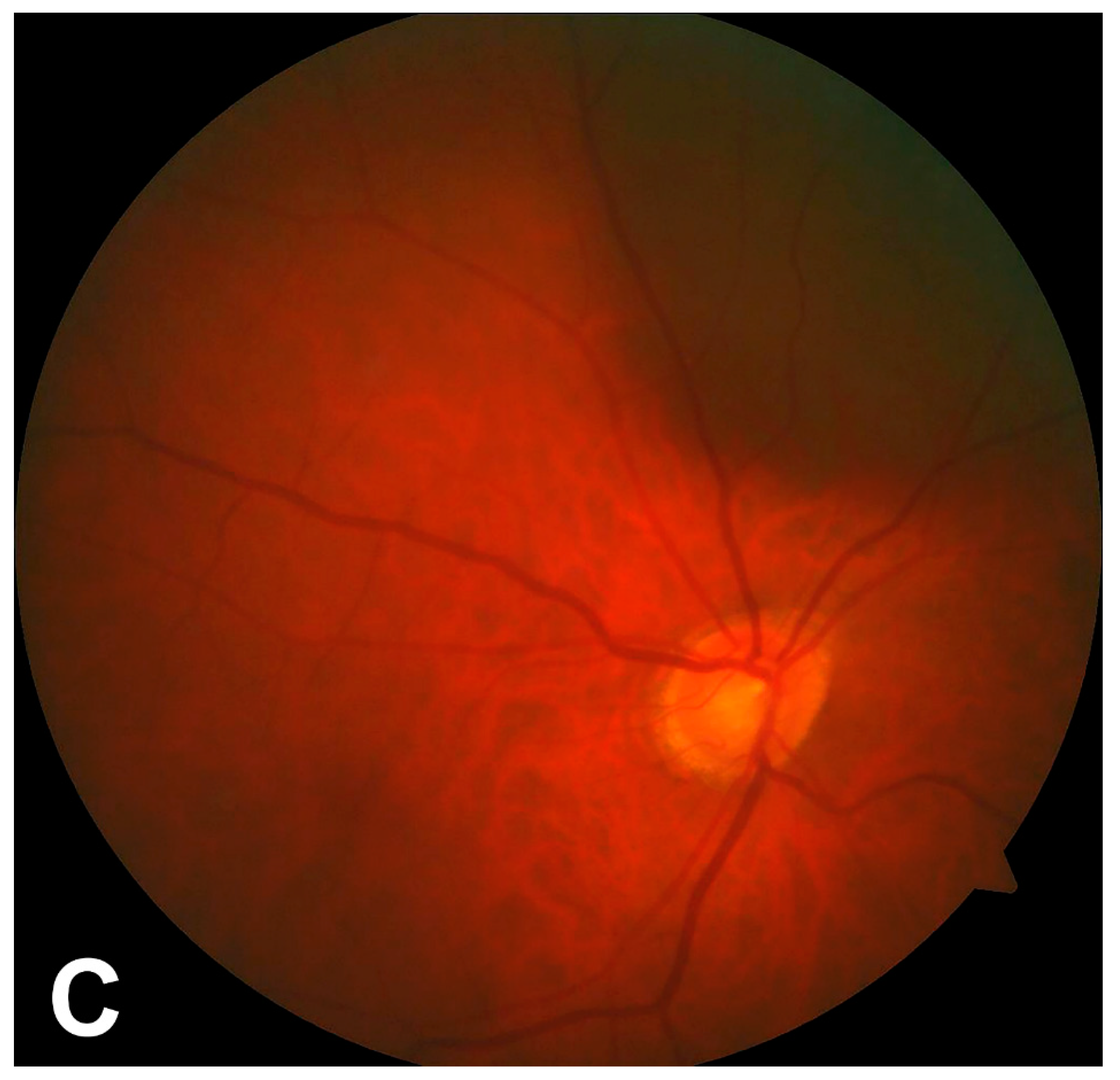 Jcm 11 01318 g002b 550