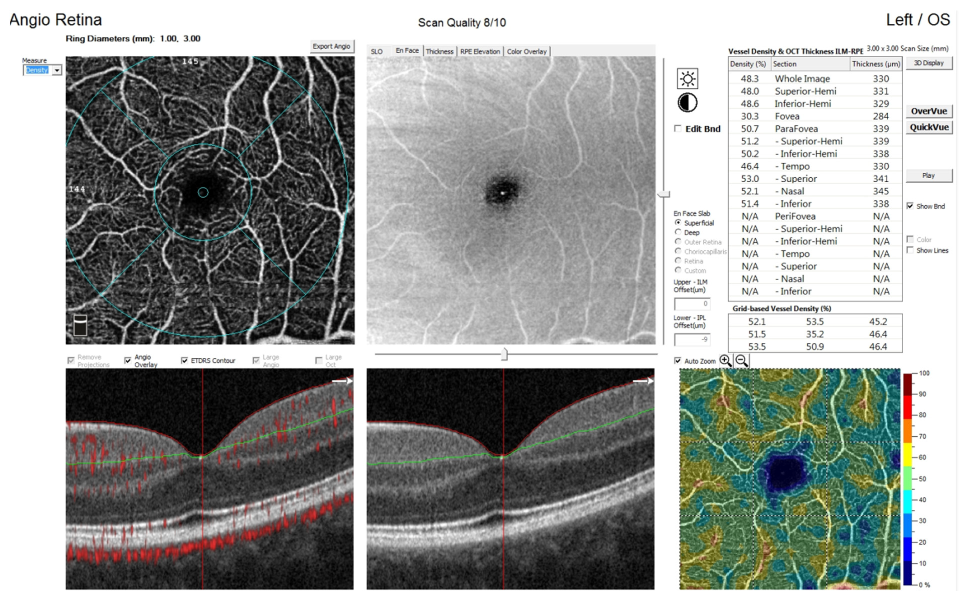 Jcm 11 01337 g002 Jcm 11 01337 g002