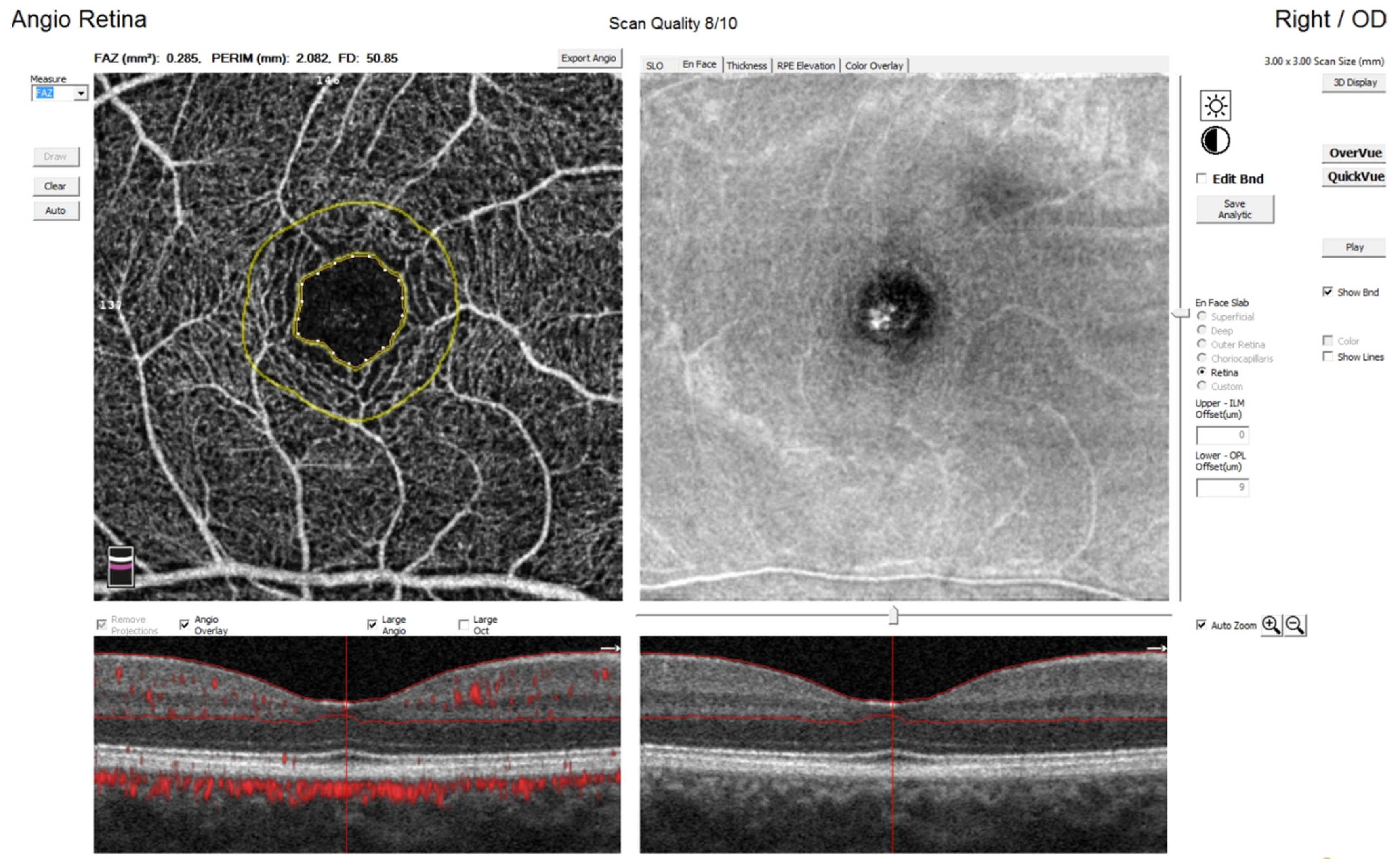 Jcm 11 01337 g003 Jcm 11 01337 g003
