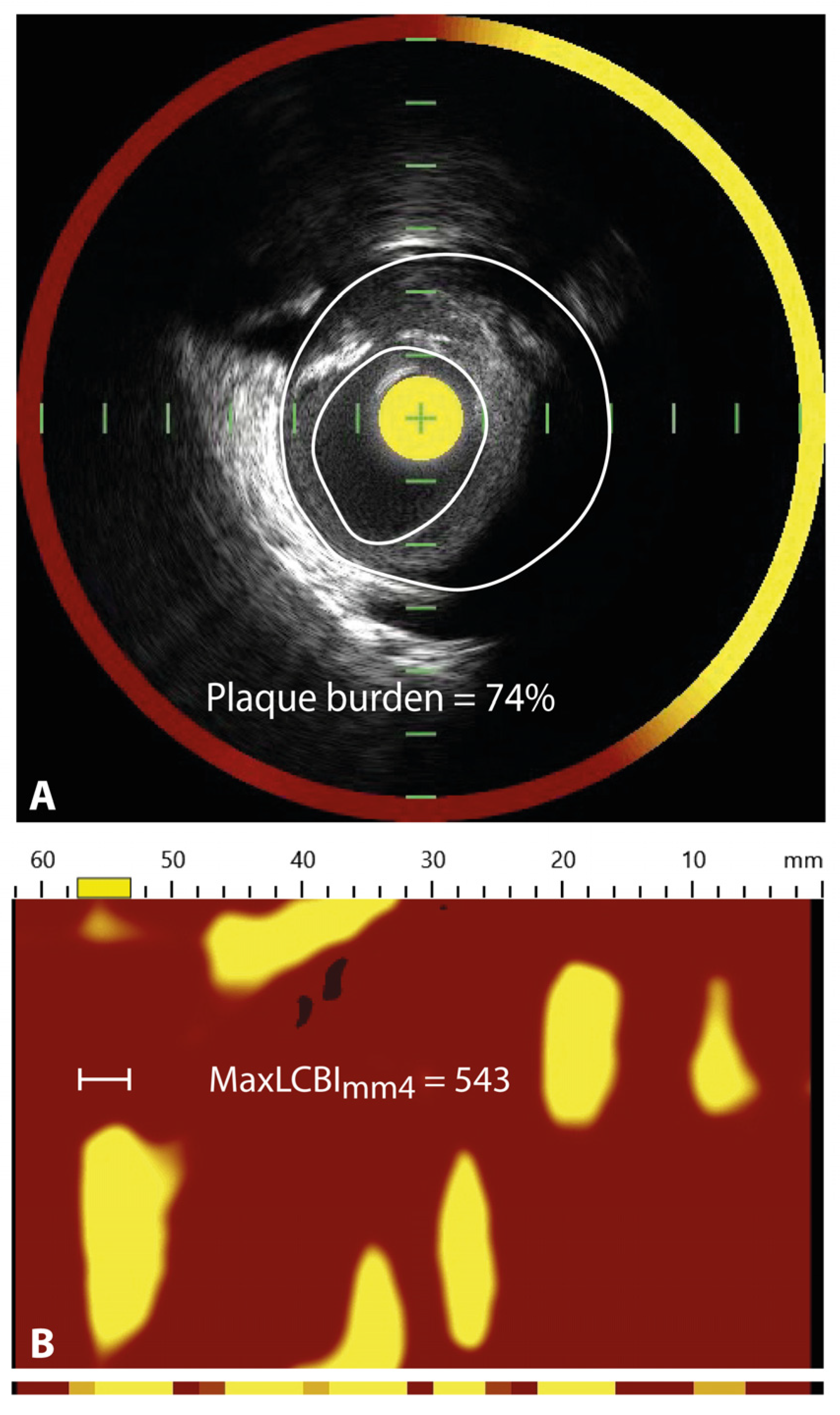 Jcm 11 01361 g004 Jcm 11 01361 g004