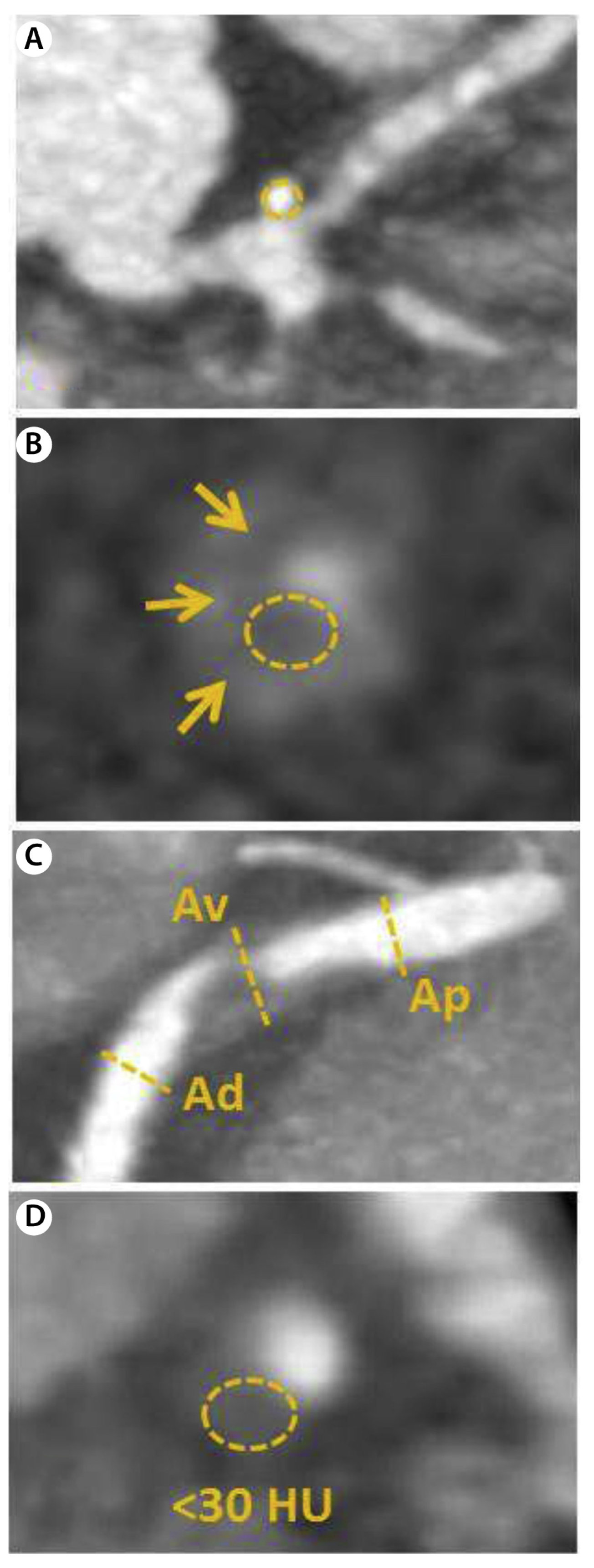 Jcm 11 01361 g006 Jcm 11 01361 g006