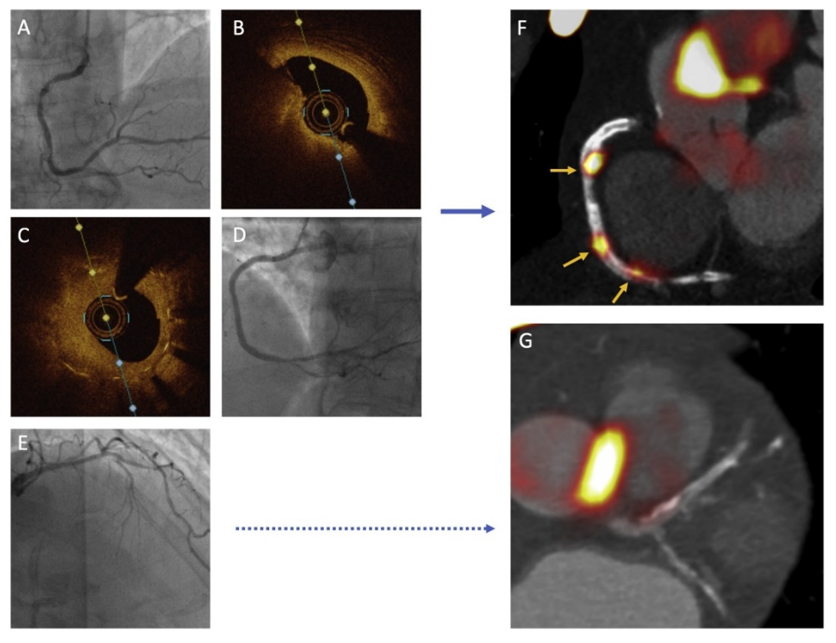 Jcm 11 01361 g008 Jcm 11 01361 g008