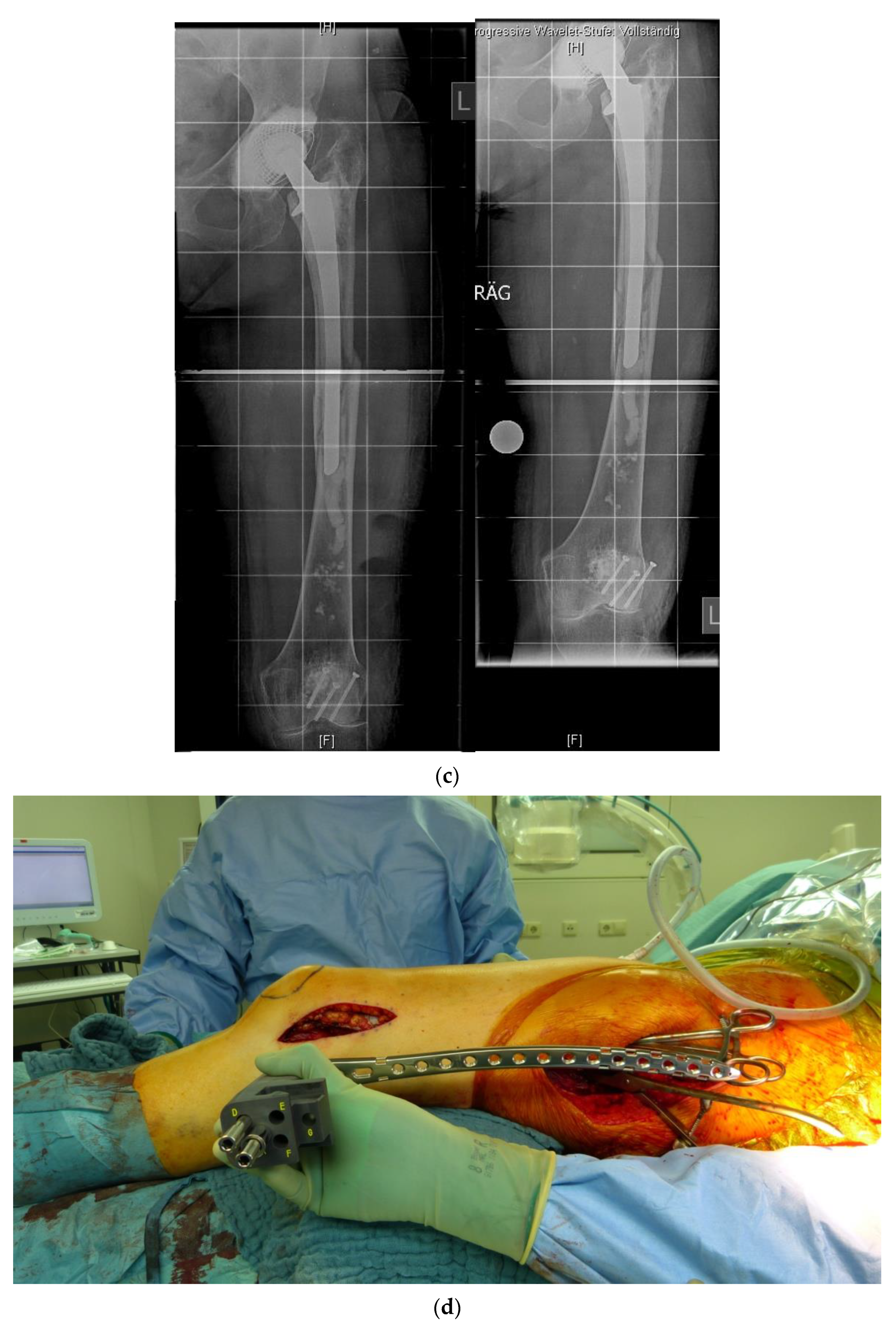 Jcm 11 01371 g003b 550